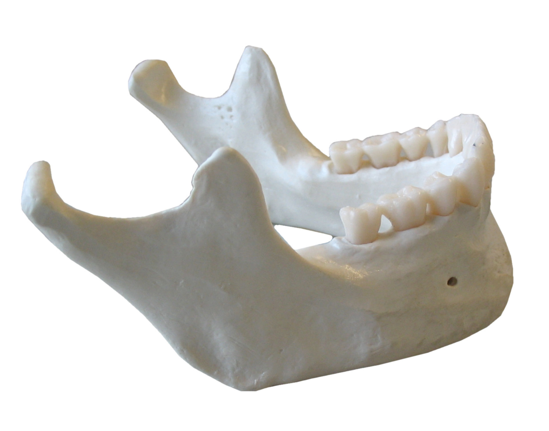 Mandibula - DocCheck Flexikon