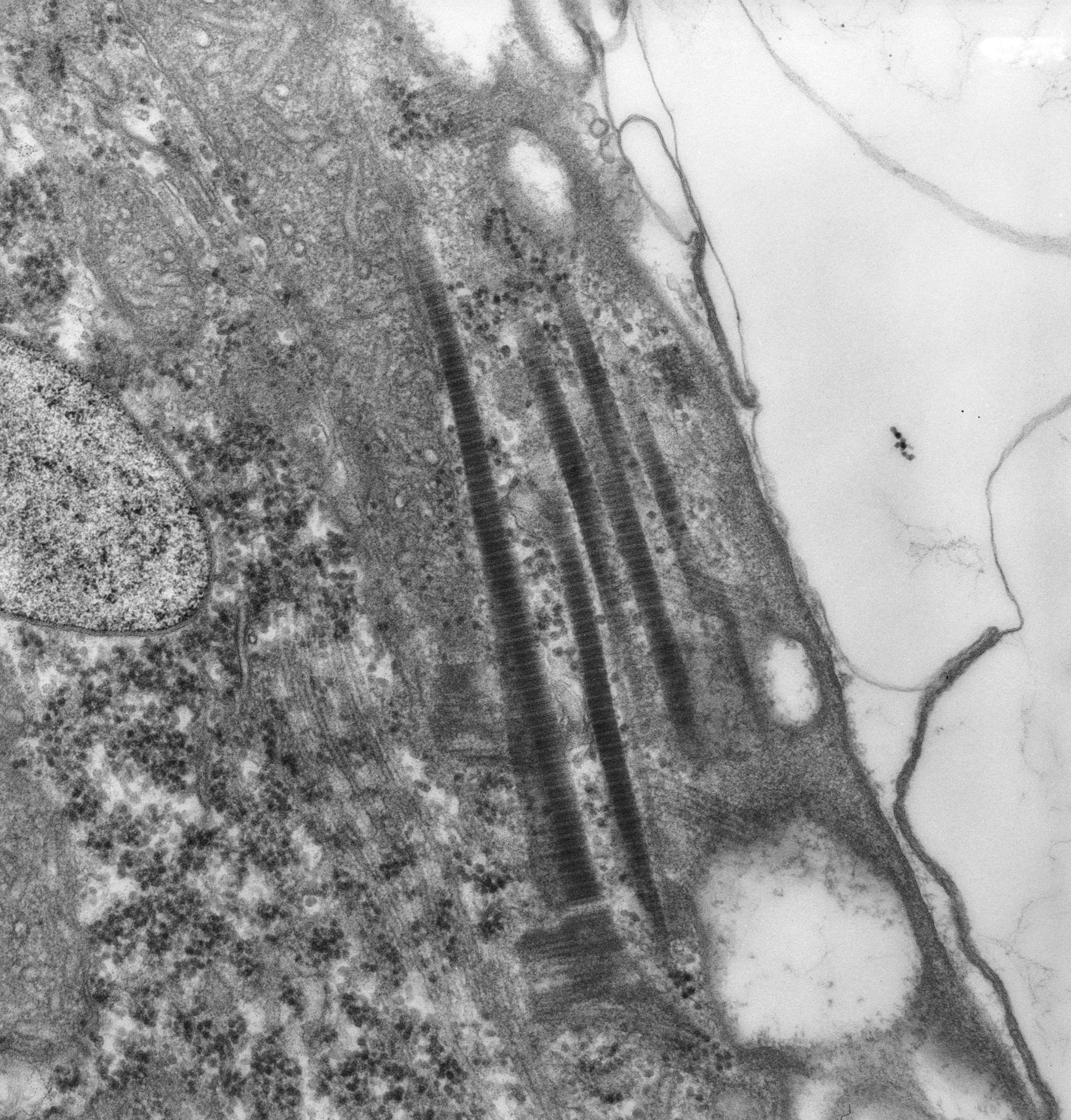 Conchophthirus curtus (Cortical membranes) - CIL:25901