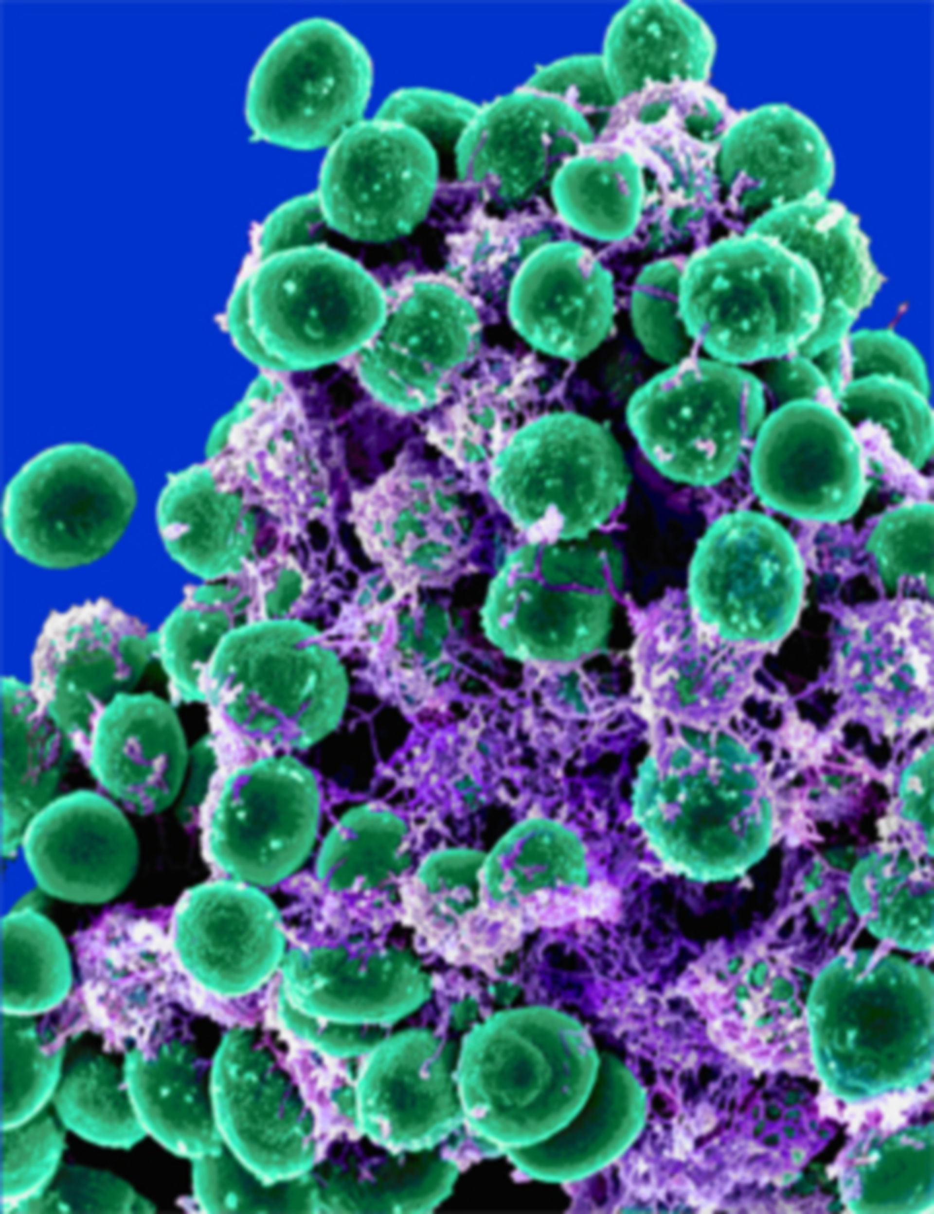 Staphylococcus epidermidis in Exopolysaccharid-Matrix (REM, koloriert)