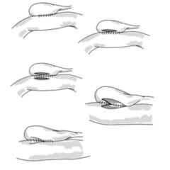 Cholezystoduodenostomie (Fleischfresser) - DocCheck Flexikon