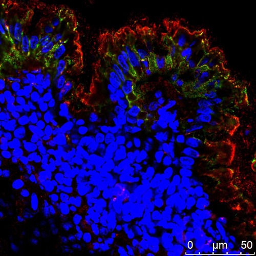 Rot eingefärbte Rho-A-Proteine in Darmepithelzellen (grün) im Darm von Patienten mit chronisch entzündlicher Darmerkrankung. © FAU/Rocío López Posadas