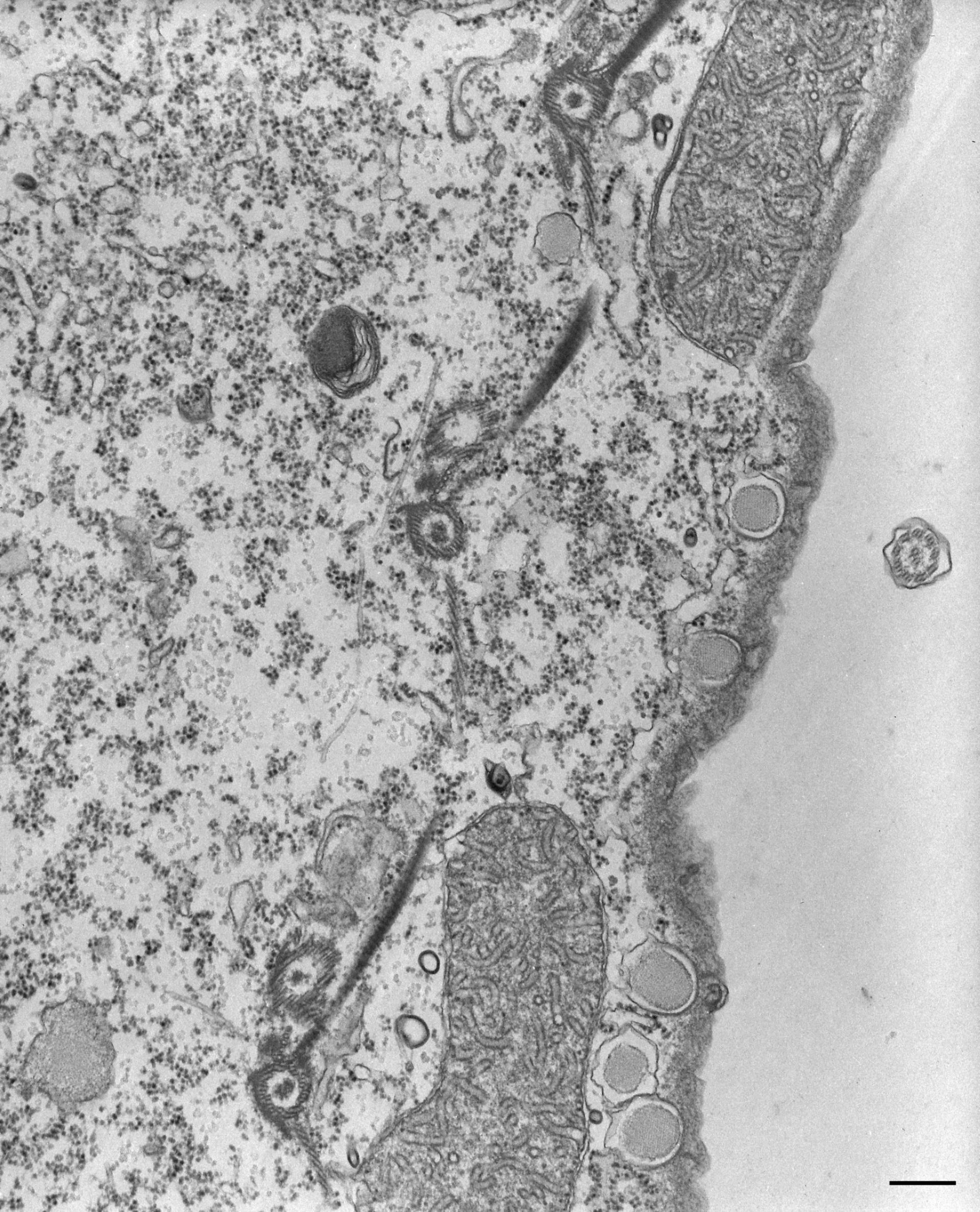 Tetrahymena pyriformis (Fibril) - CIL:36291