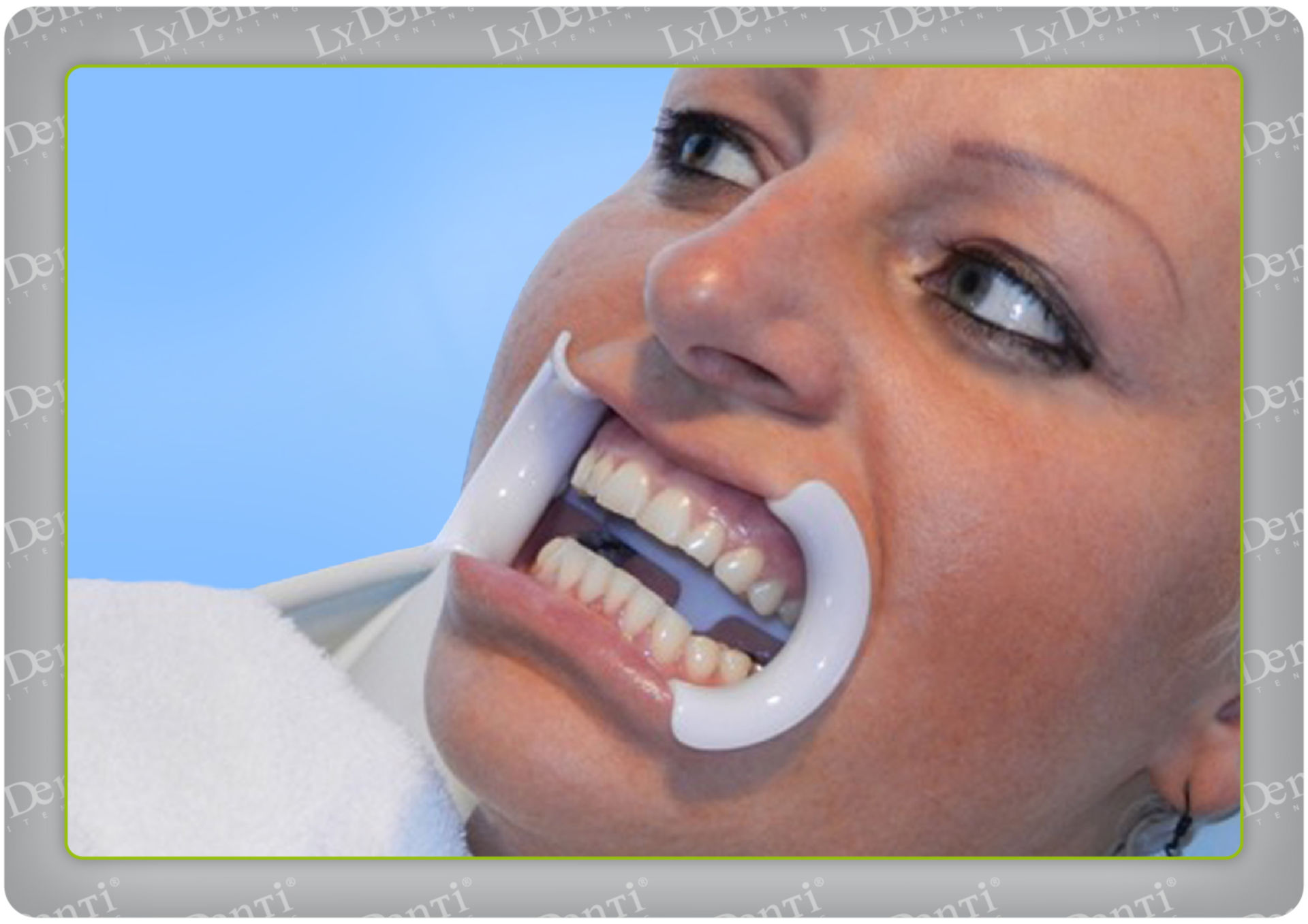 Blanqueamiento dental (14)