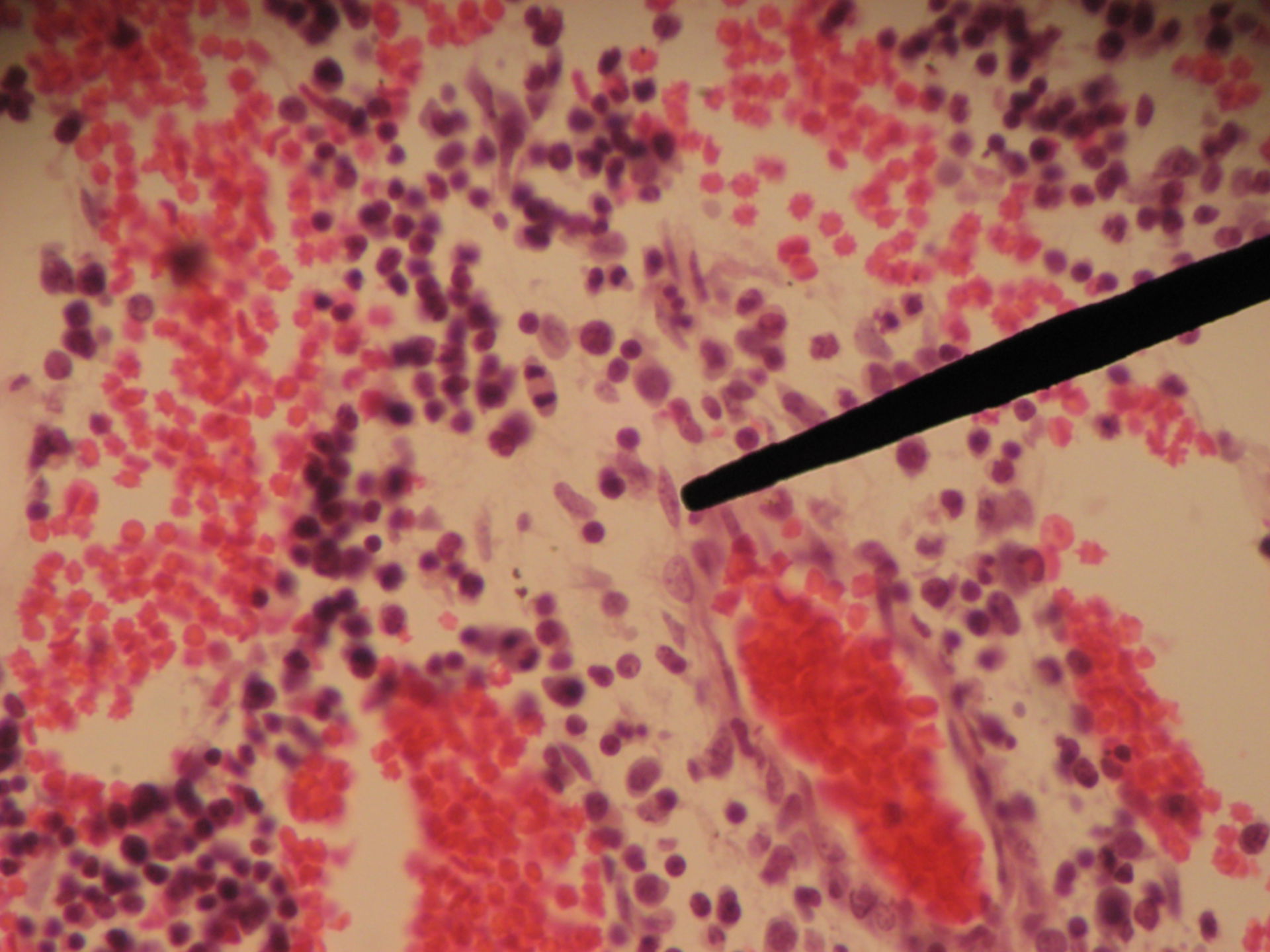 Rotes Knochenmark eines Schweinefetus (9) - Retikulumzelle