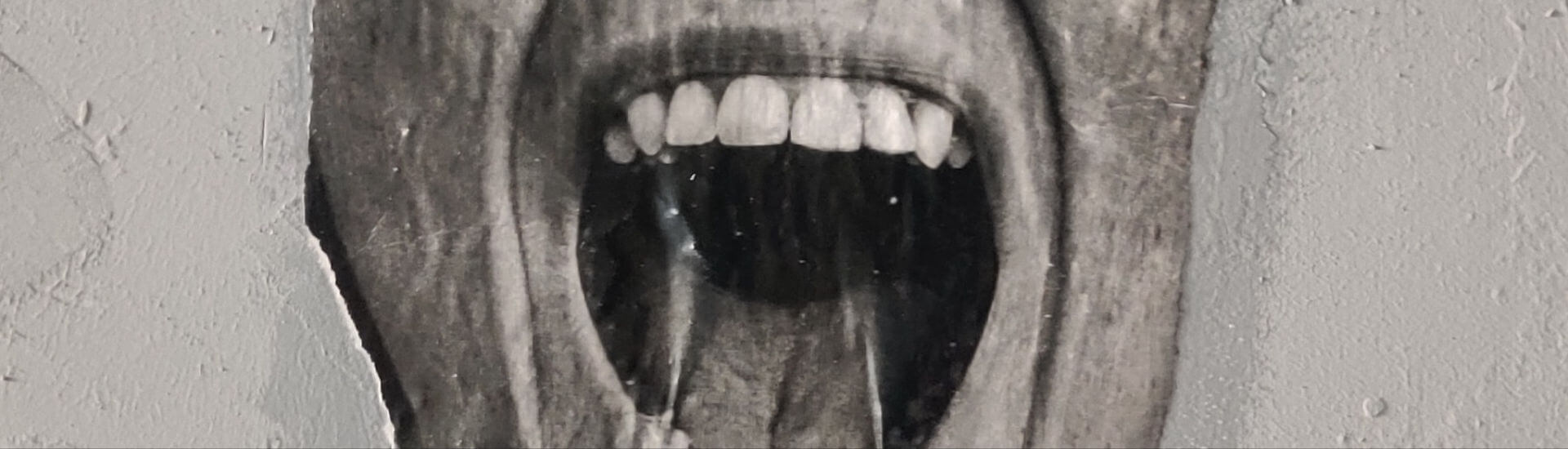 Innovative Advances in Dentistry Electrified Teeth, Middle Ages Dental