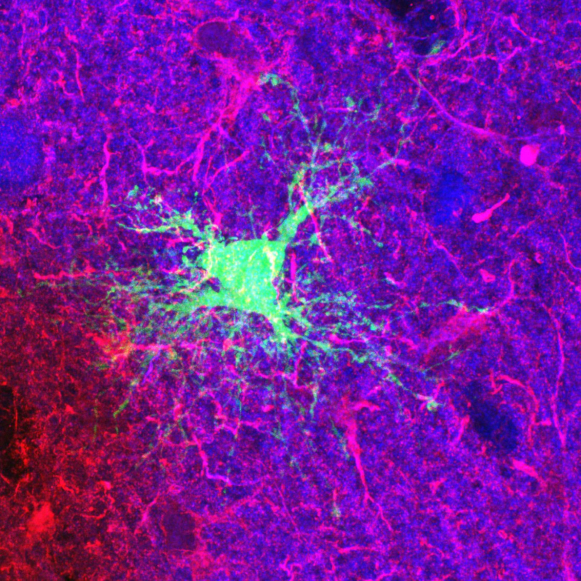 Astrocytes! - Image of the Week - July 13, 2015 - CIL:47041