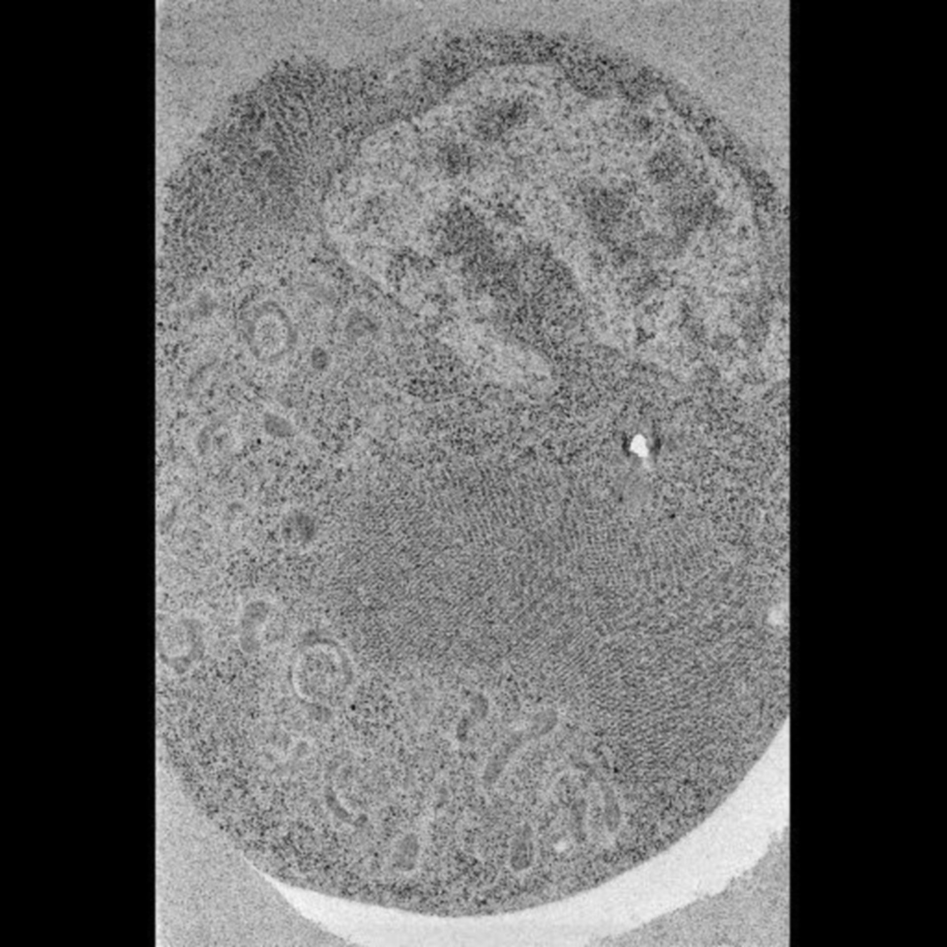 Drosophila melanogaster (Cell body) - CIL:40114