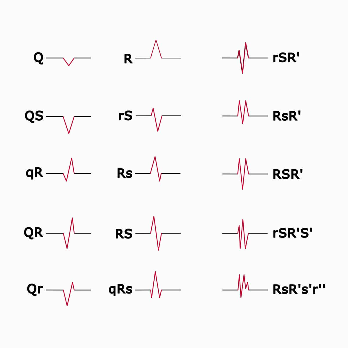 Schematische Darstellung von QRS-Konfigurationen