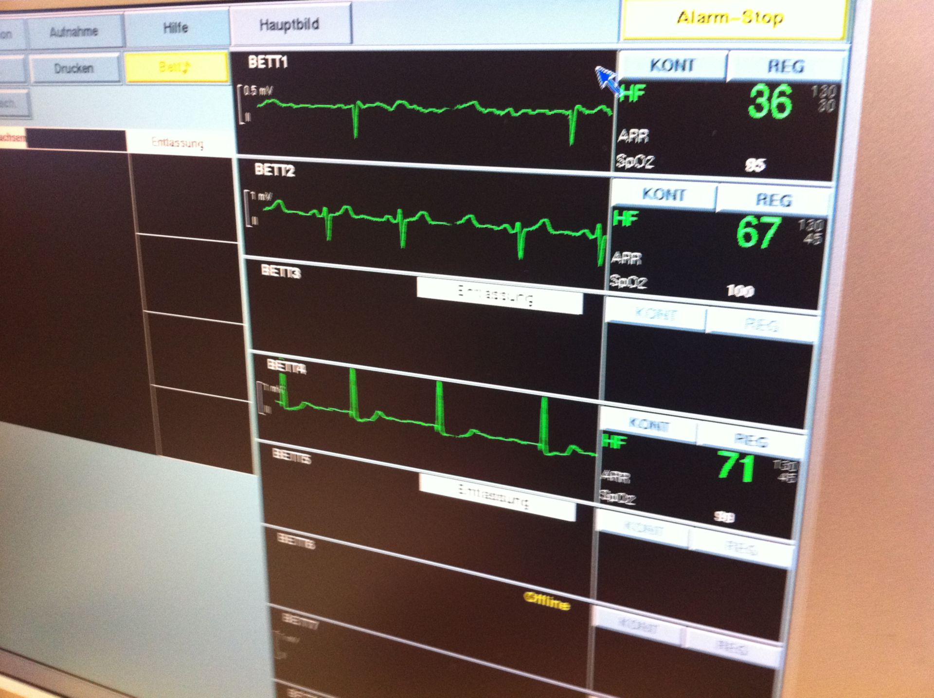 Monitor Center in the Intensive Care