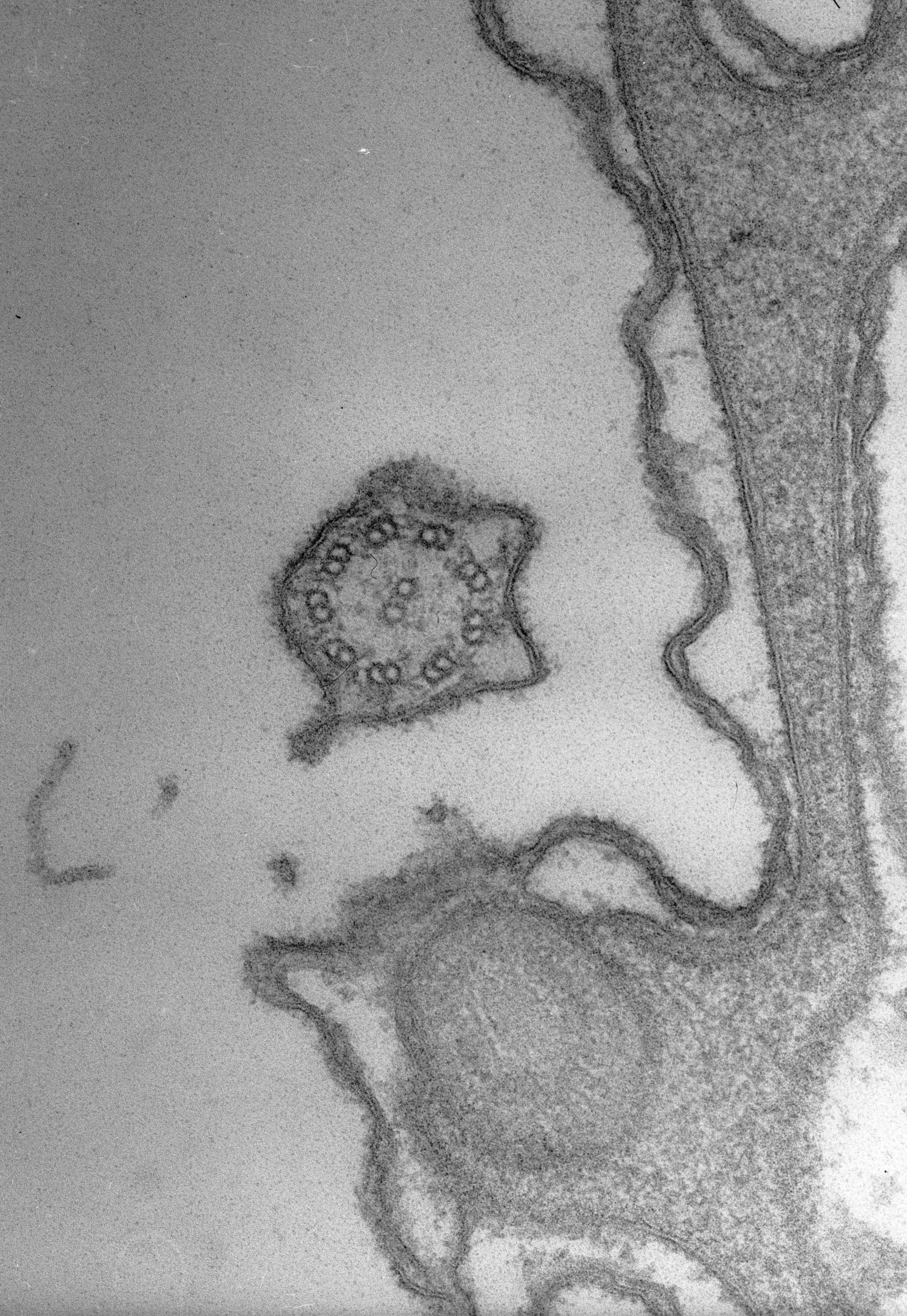 Paramecium caudatum (Pellicle) - CIL:38893