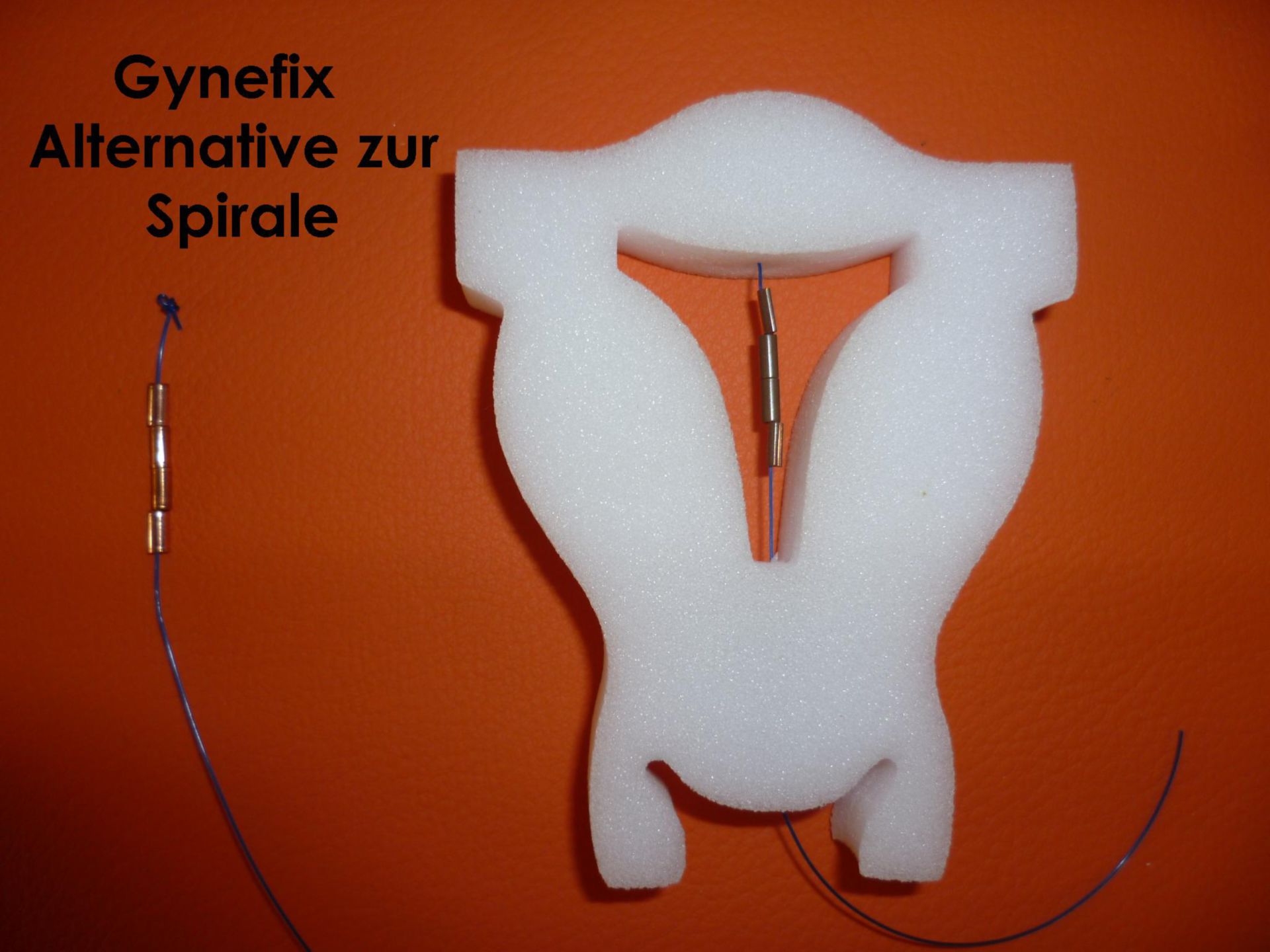 Gynefix - Einlage ohne Schmerzen in Frauenarztpraxis Berlin-Mitte mit örtlicher Betäubung