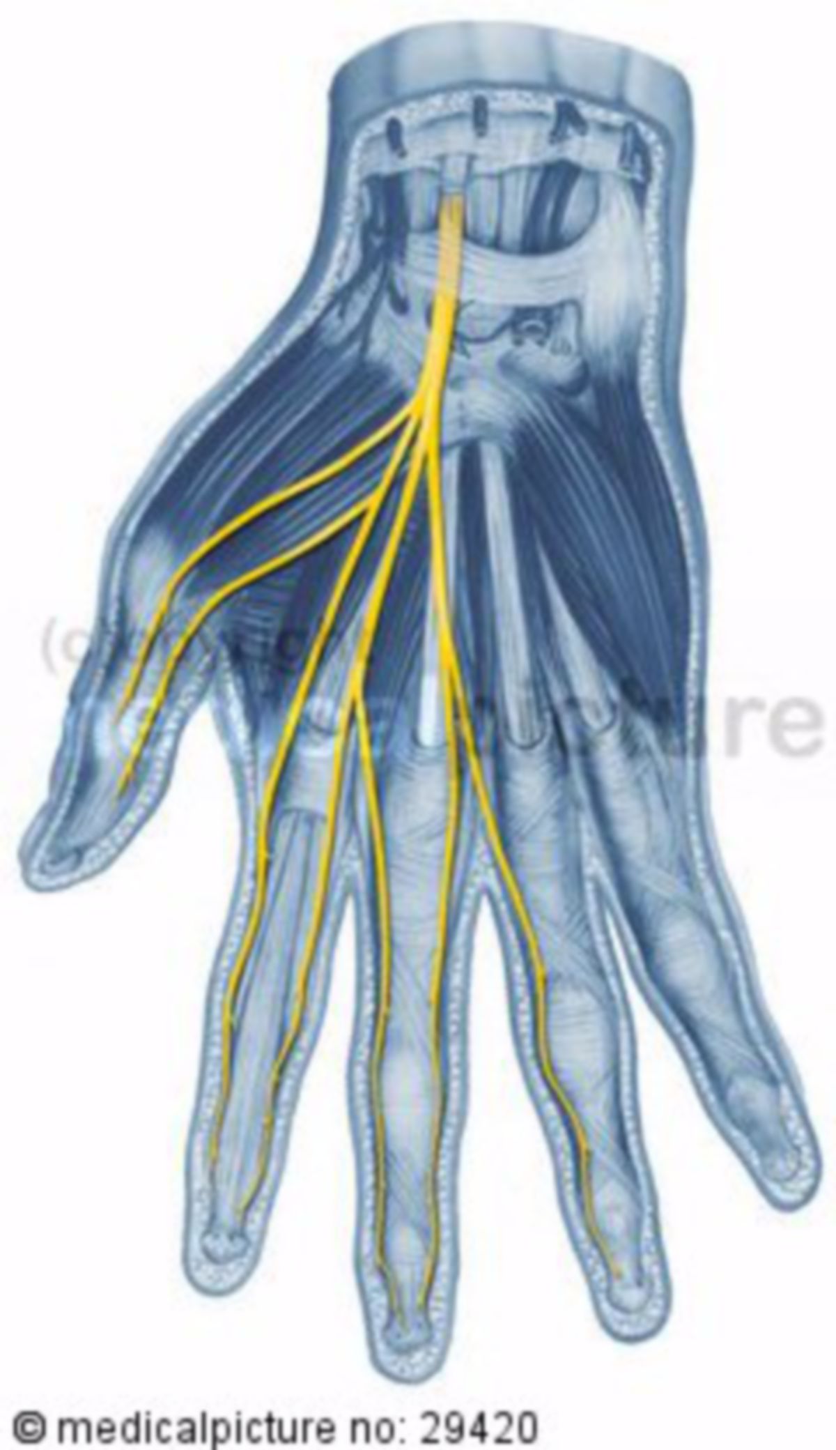 Nervus medianus der rechten Hand
