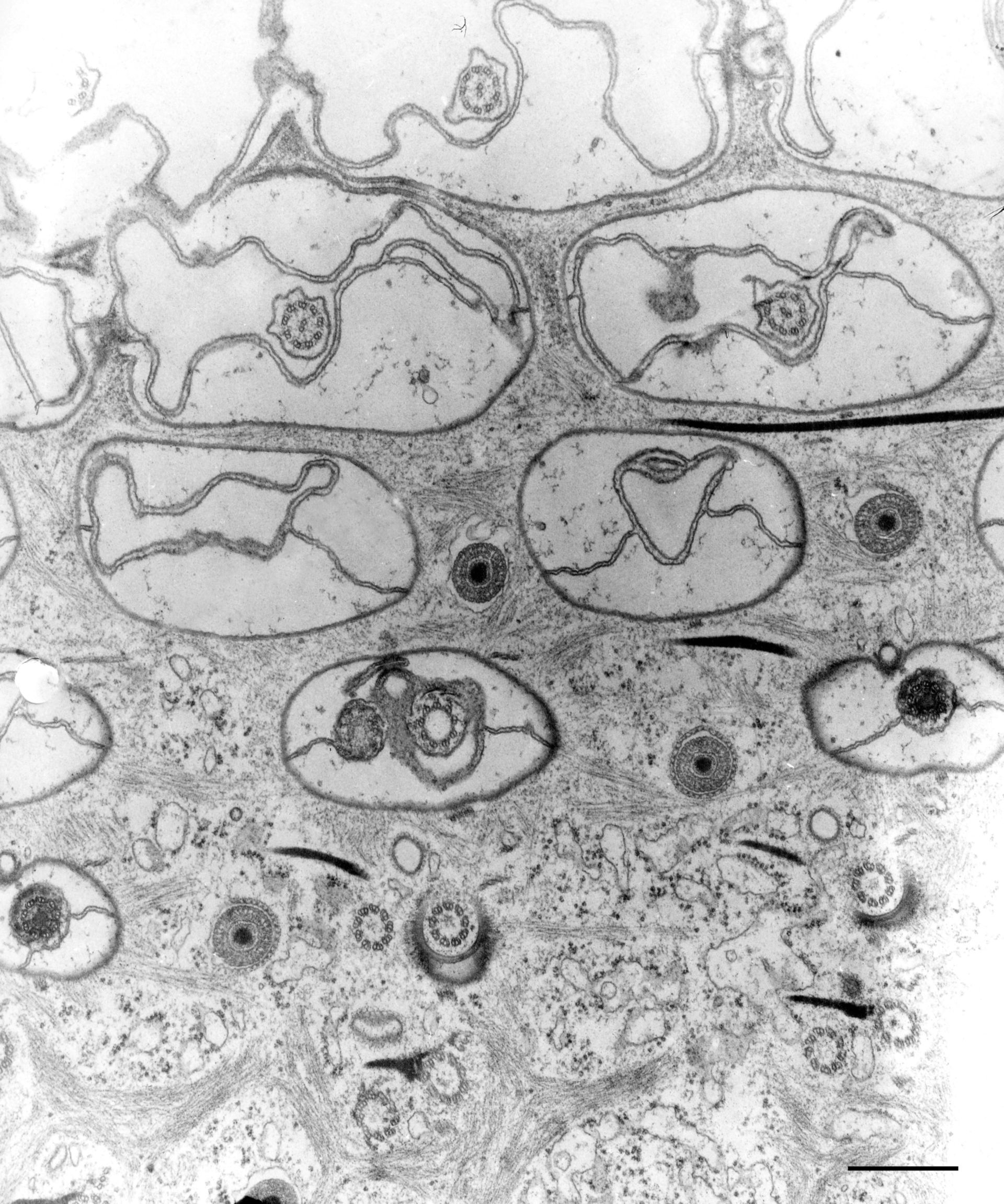 Paramecium caudatum (Microtubule basal body) - CIL:36756