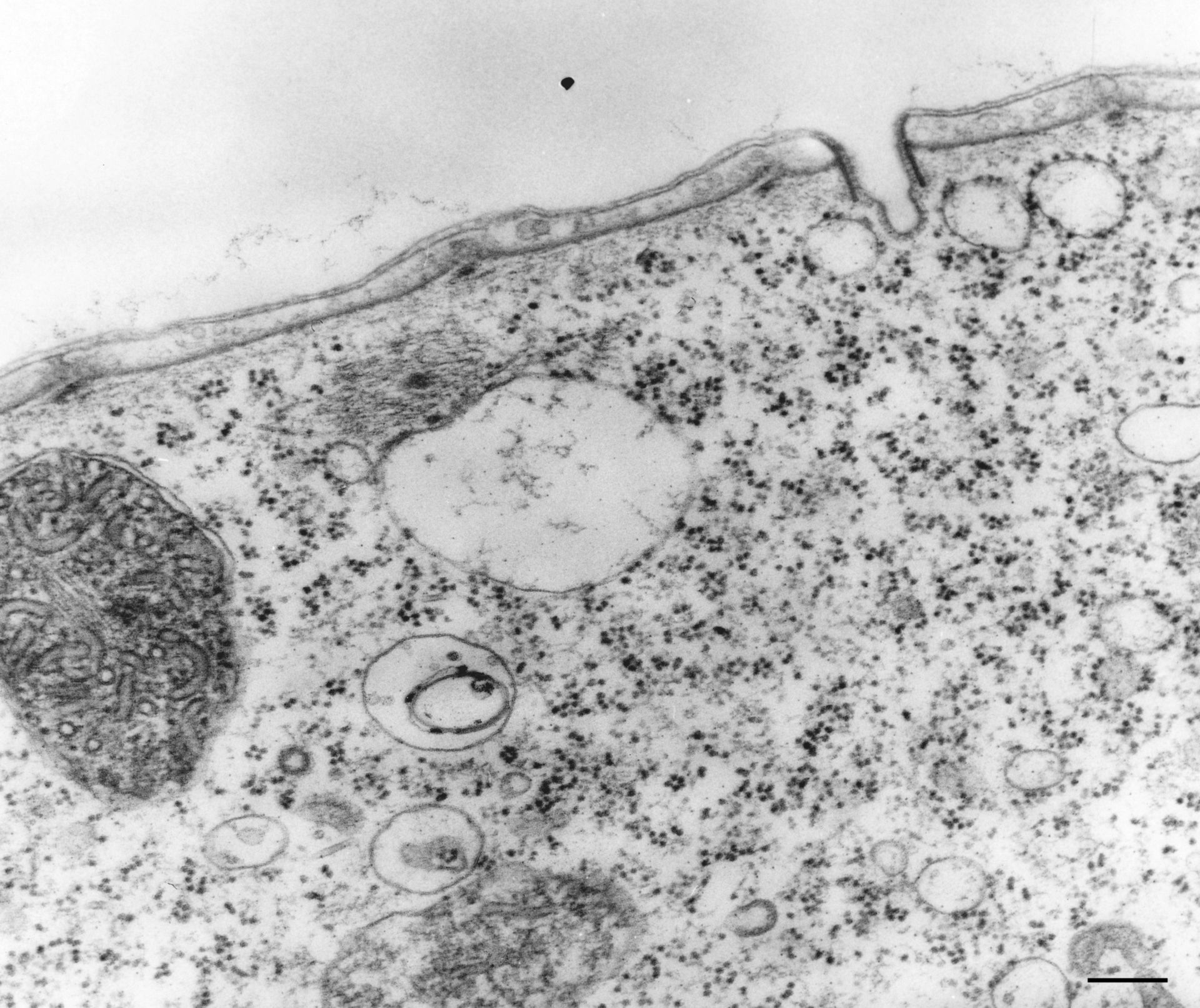 Vorticella convallaria (Rough endoplasmic reticulum membrane) - CIL:36257