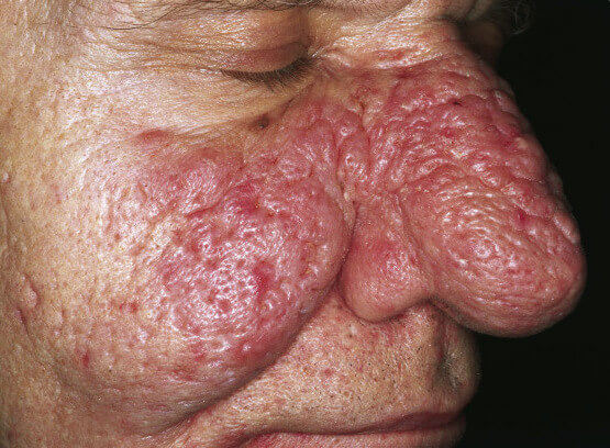 derm05_original_original.jpg