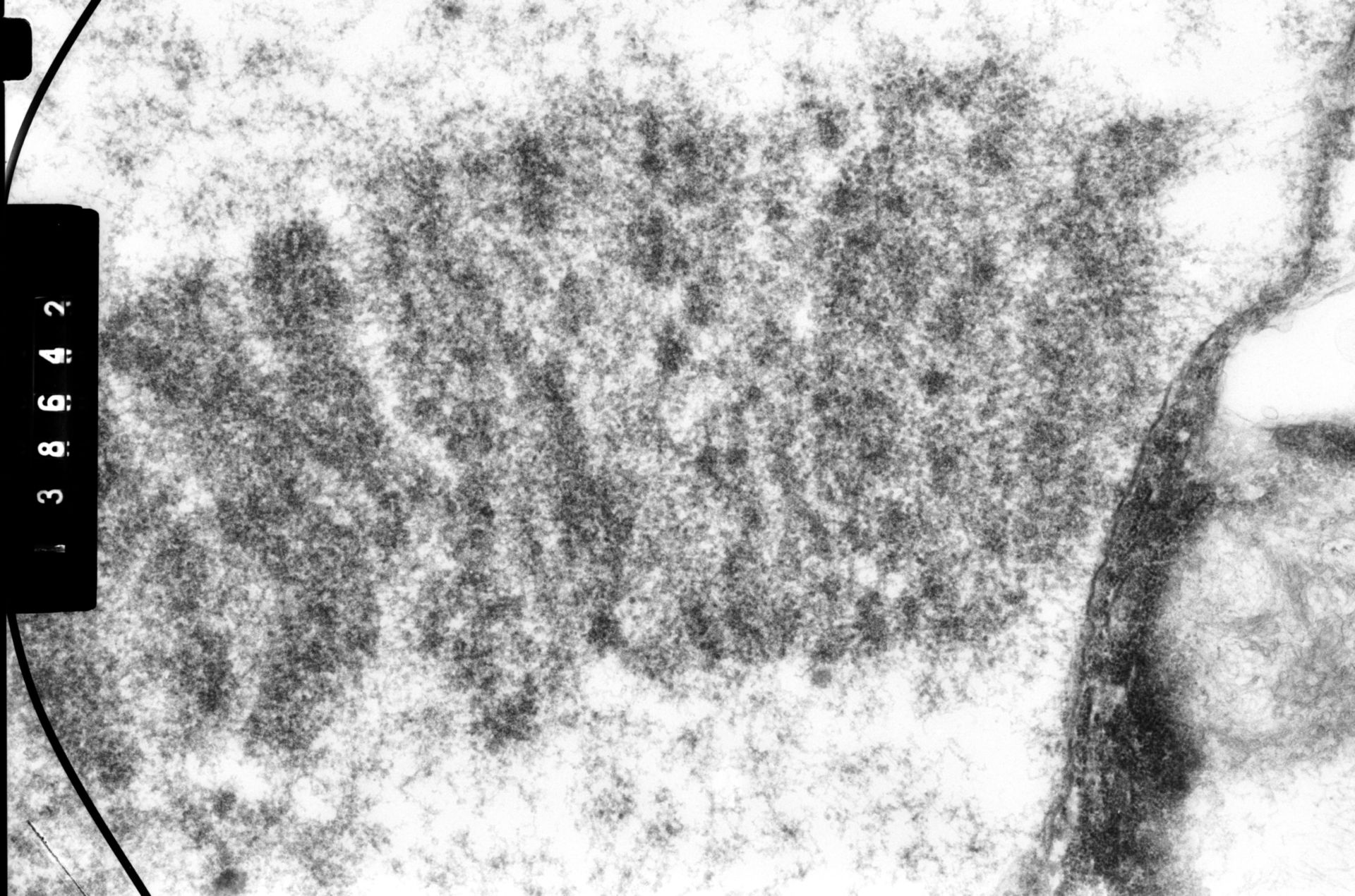 Drosophila melanocephala (Polytene chromosome) - CIL:35386
