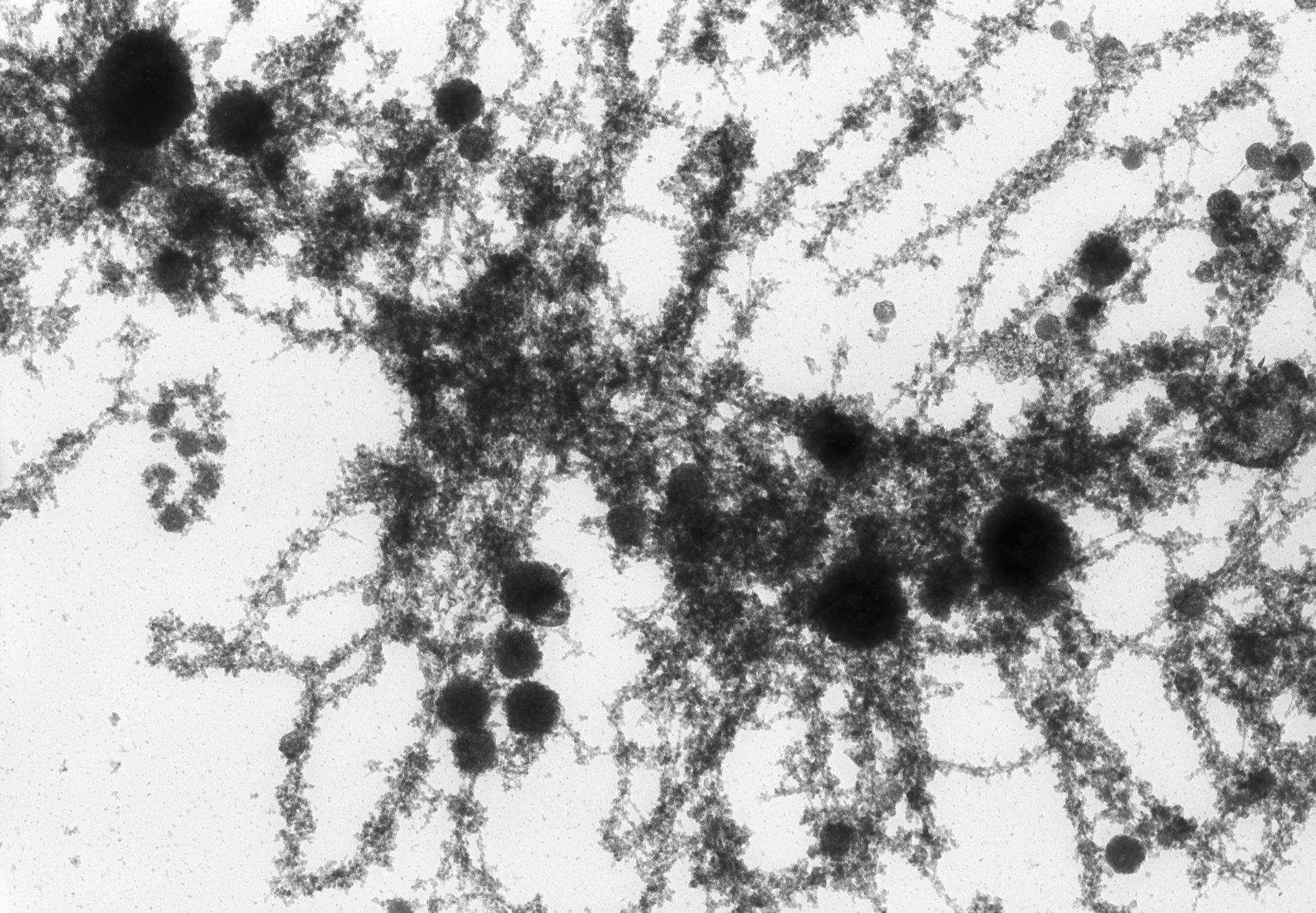 Notophthalmus viridescens (Lampbrush chromosomes) - CIL:10705