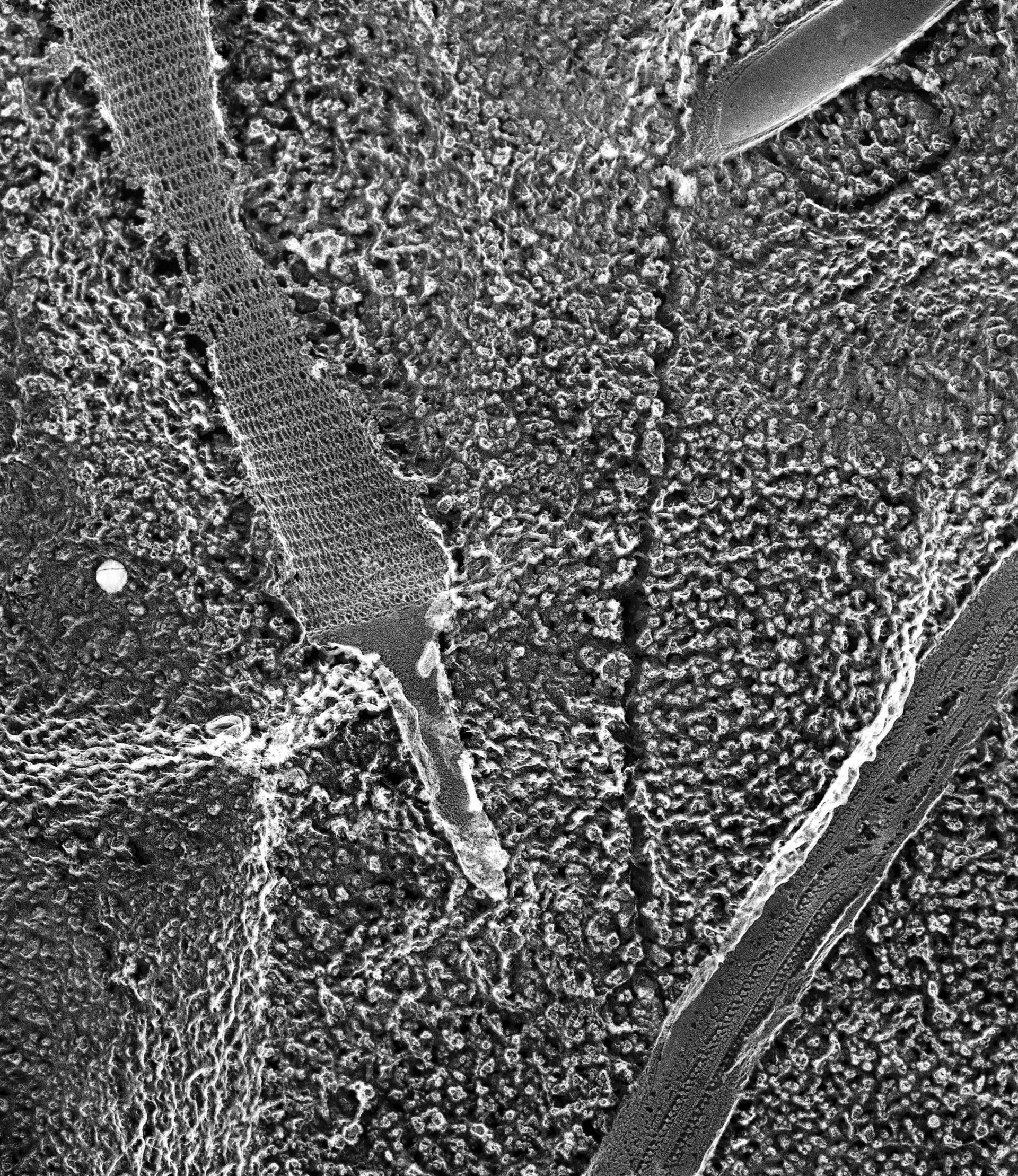 Paramecium multimicronucleatum (Trichocyst) - CIL:12035
