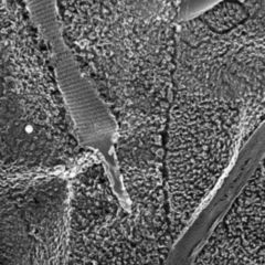 Protrusion DocCheck Flexikon