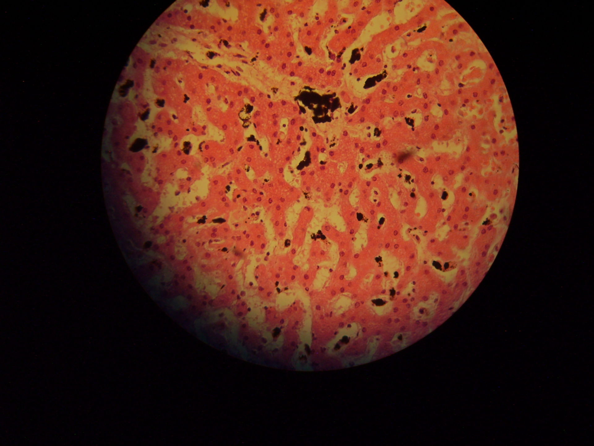 Lebergewebe (Schizonten)