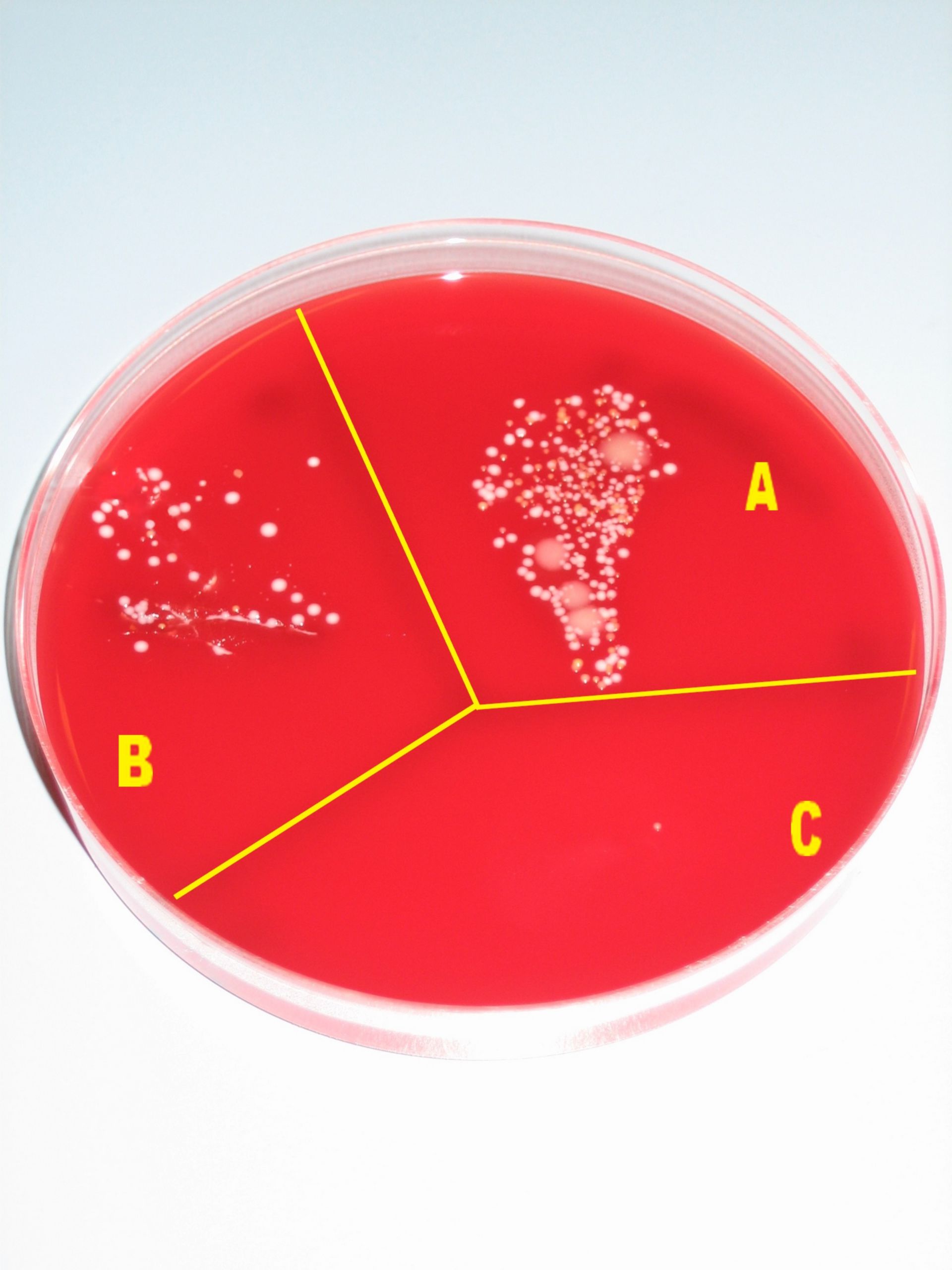Blood agar plate