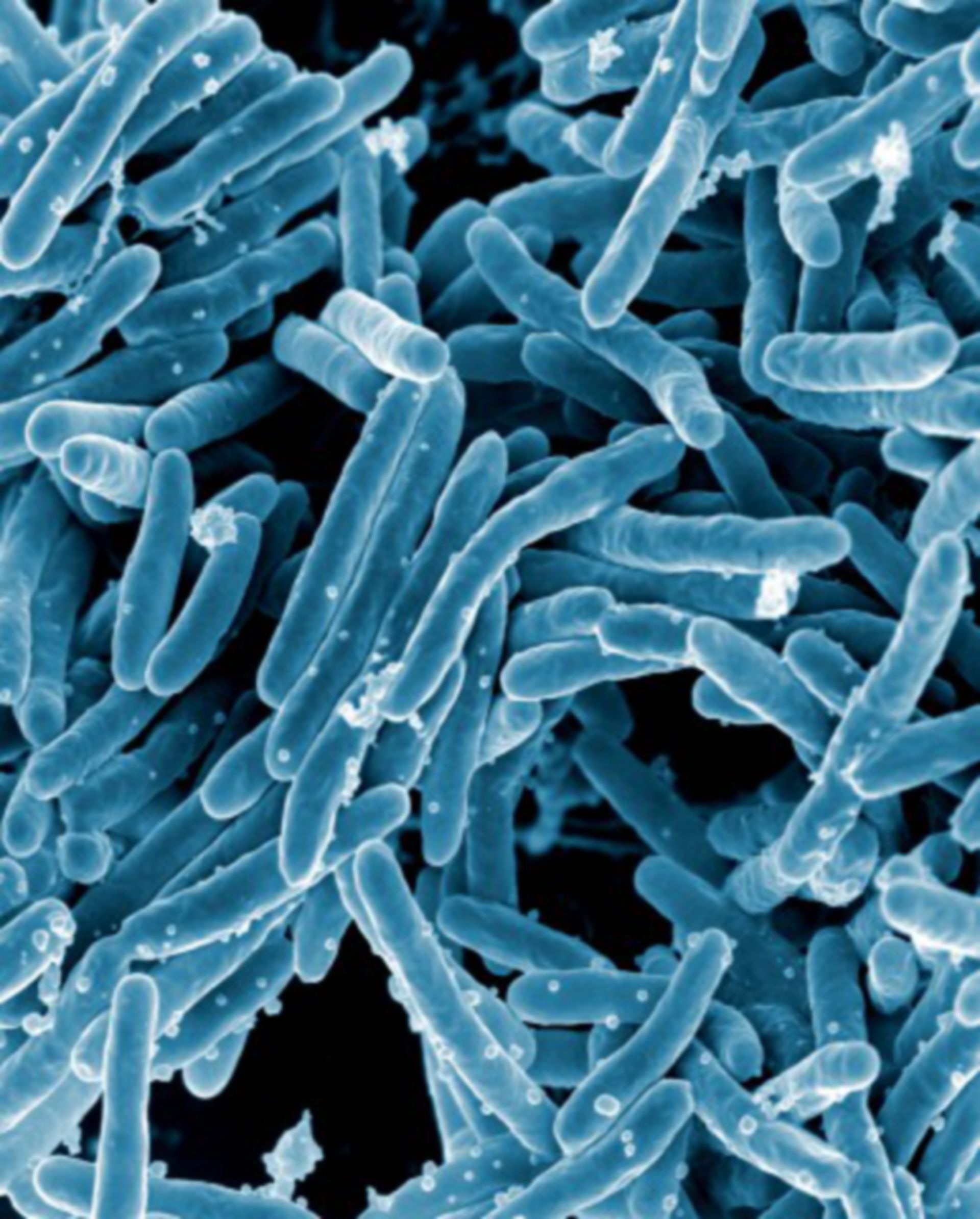 Mycobacterium tuberculosis Bakterien (REM)