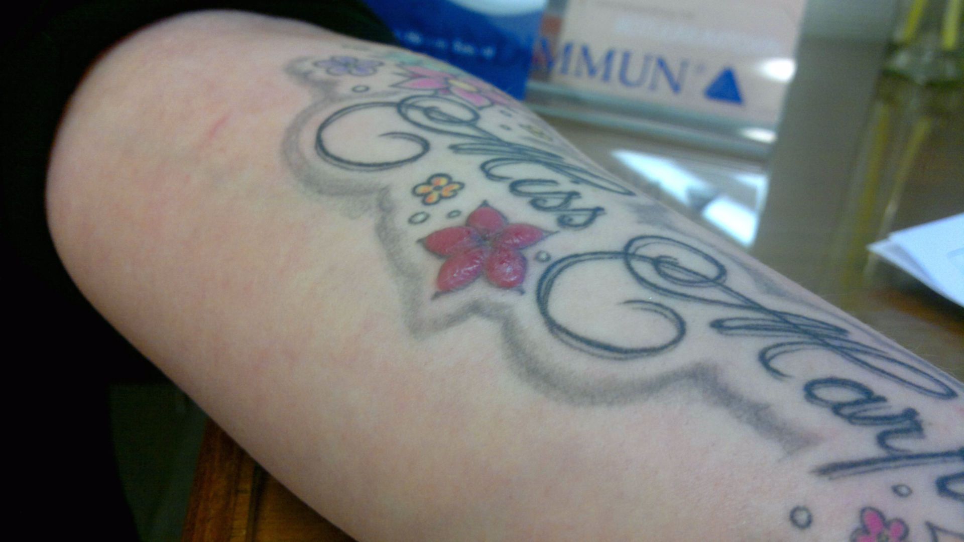 Safety tattoos, bands warn of kids' deadly allergies