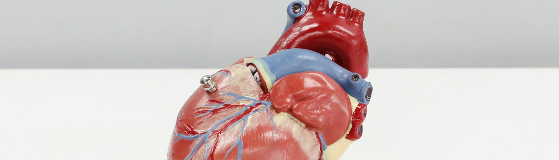 Herzklappenersatz Lieber zum Katheter greifen? DocCheck