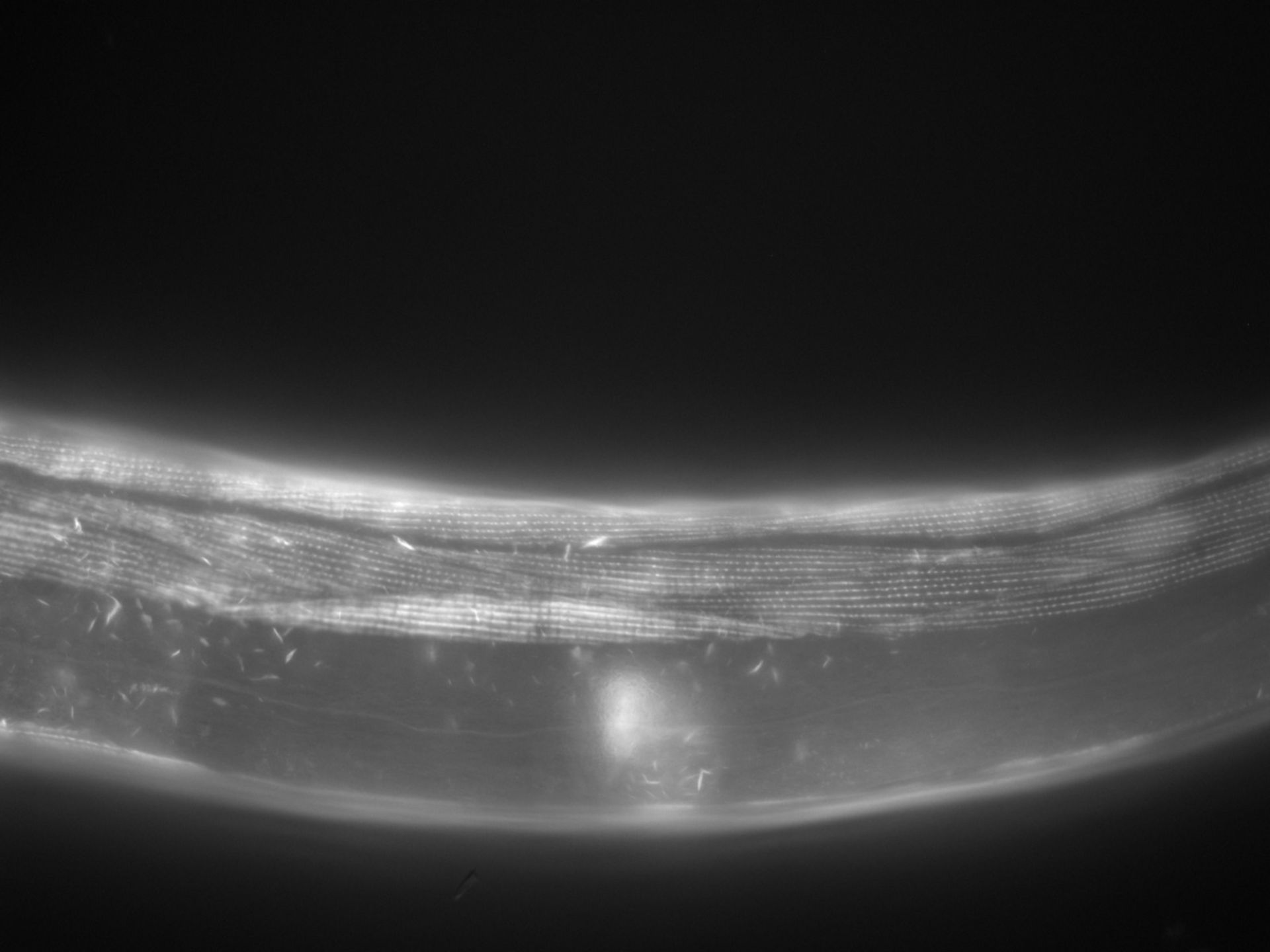 Caenorhabditis elegans (Actin filament) - CIL:1047