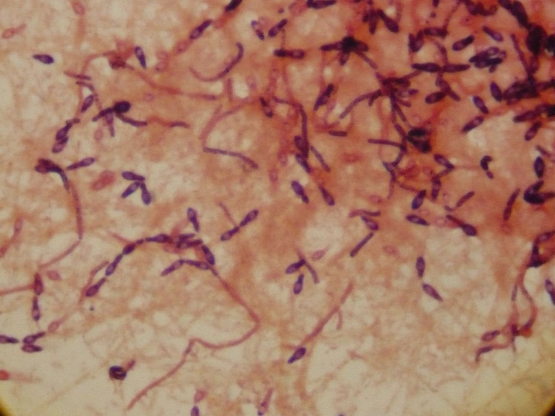 Кластридии. Клостридии столбняка под микроскопом. Clostridium botulinum микроскопия. Clostridium botulinum окраска. Clostridium tetani микроскопия.