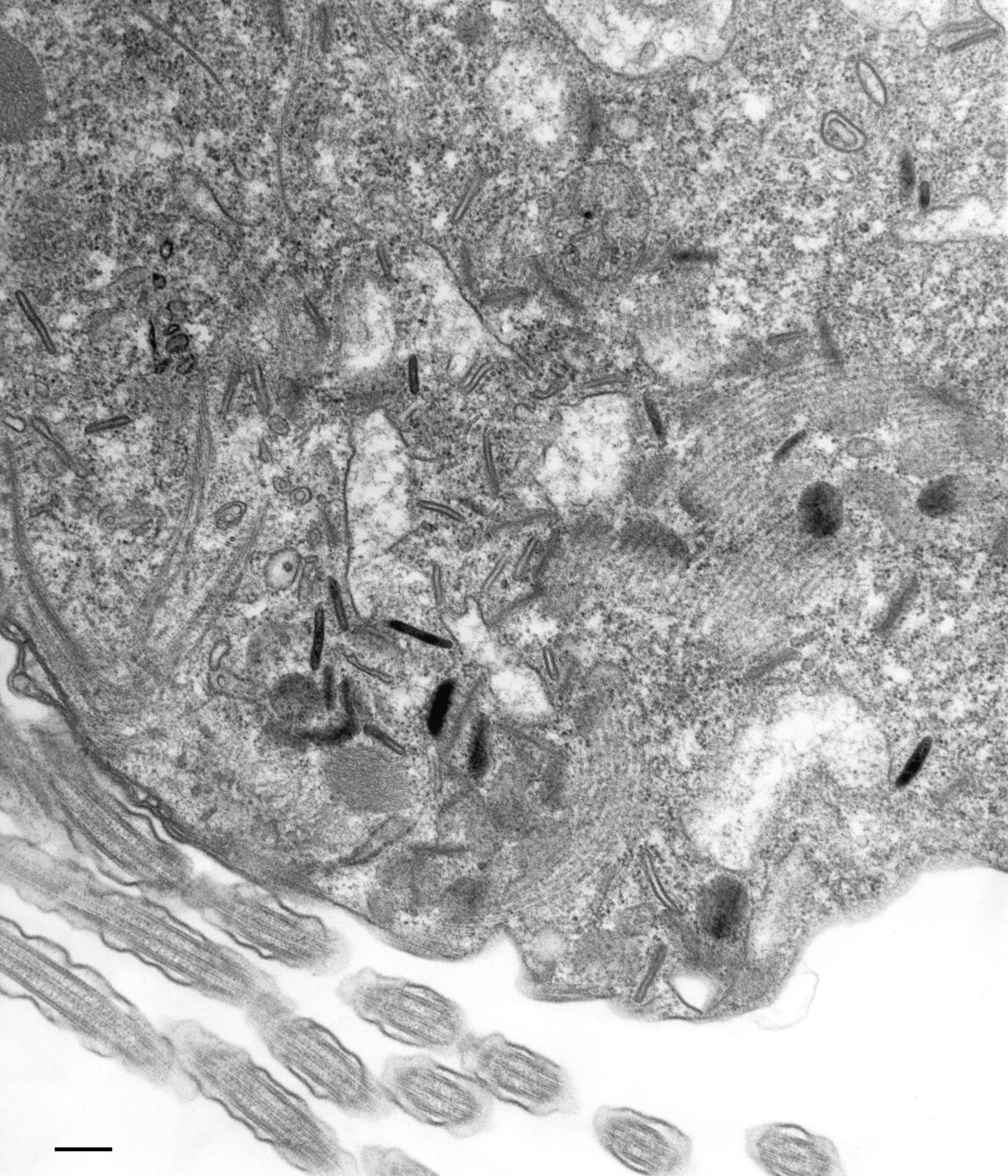 Paramecium multimicronucleatum (Microtubule associated complex) - CIL:36706