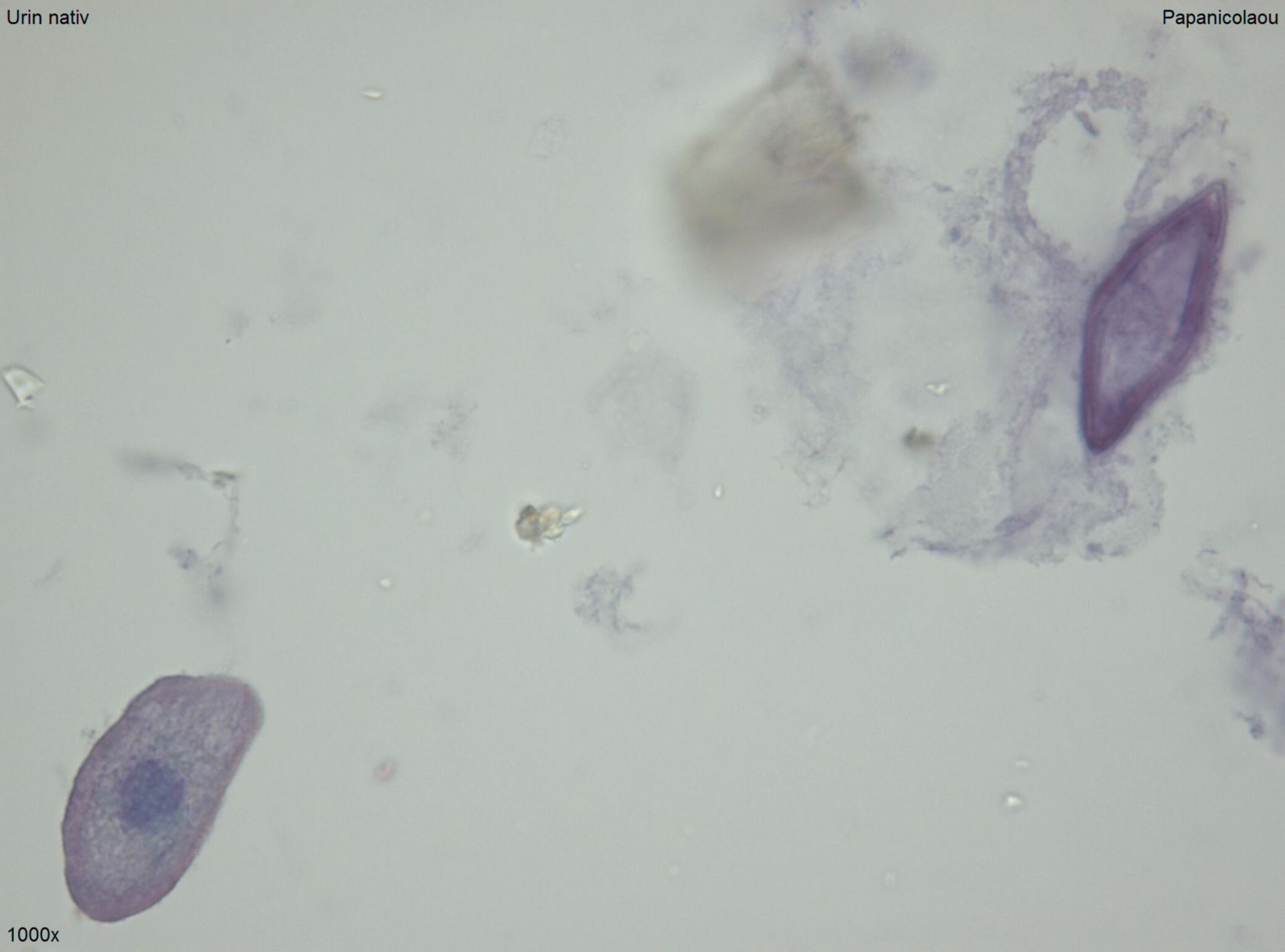 Schistosomeneier oder Pollen 2