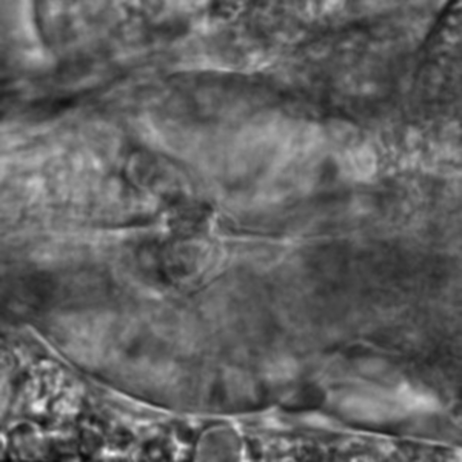 Caenorhabditis elegans - CIL:2129