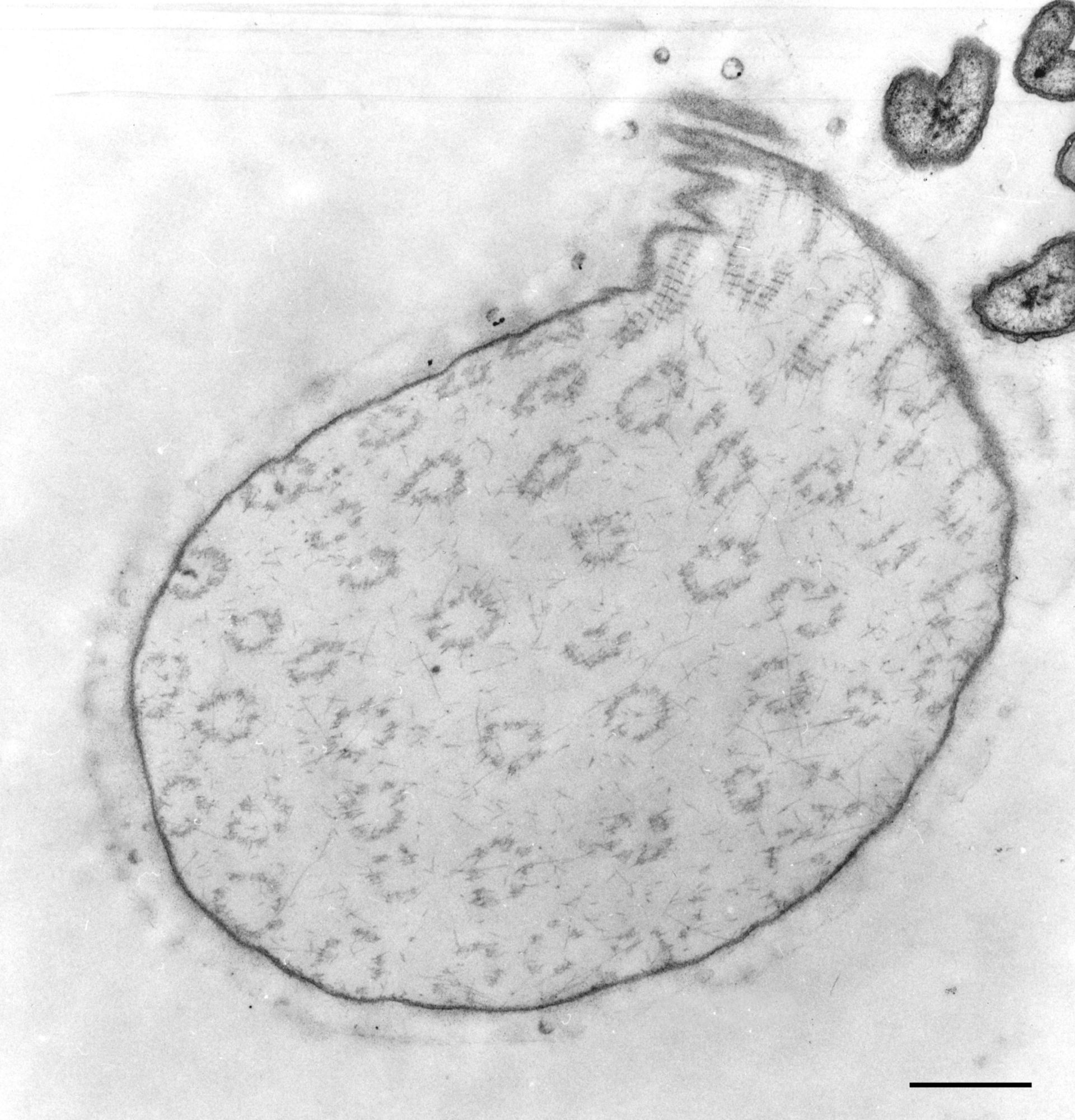 Opercularia coarctata (Extracellular matrix) - CIL:9920