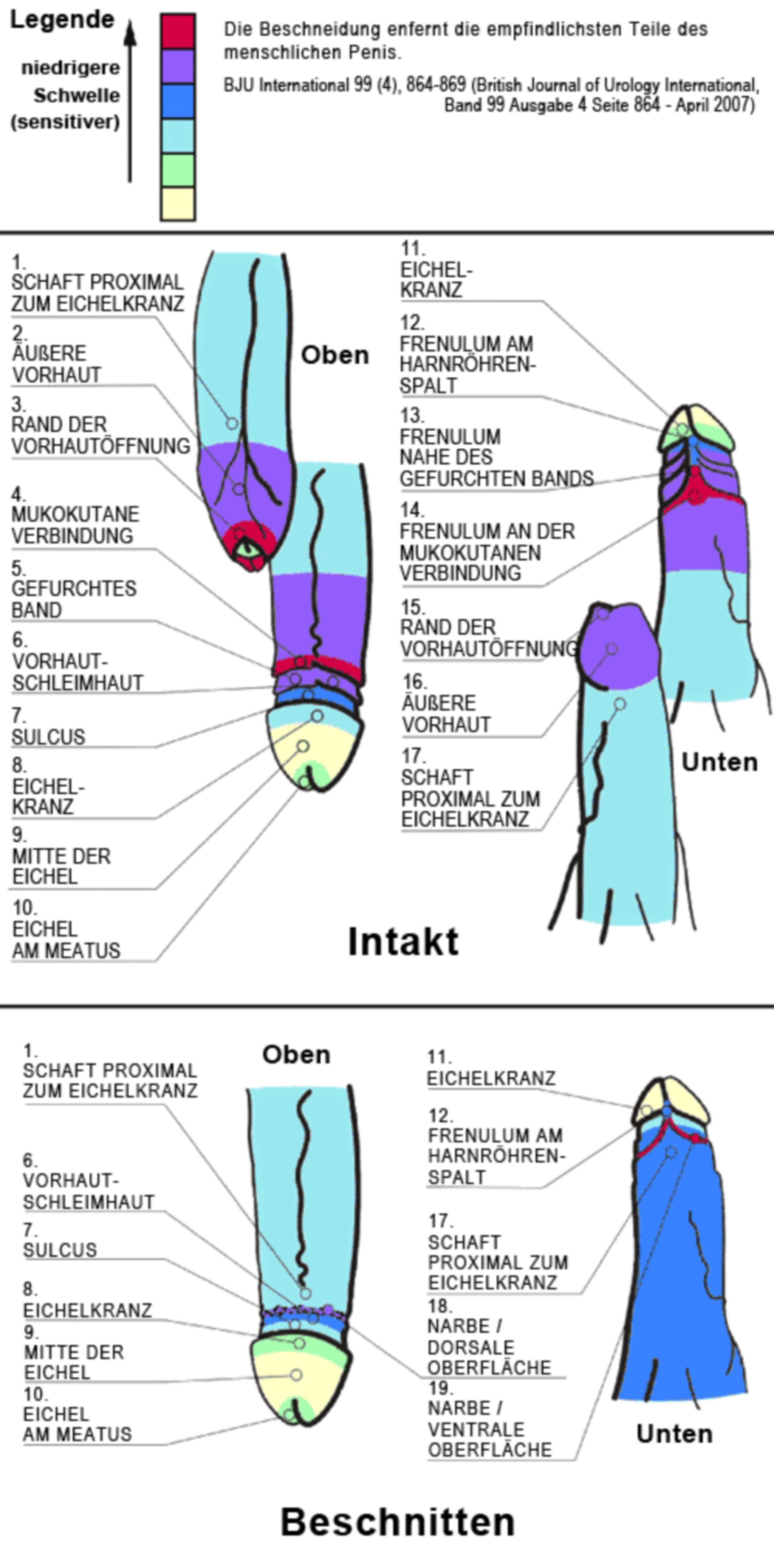 Anatomische Darstellung vor und nach einer Beschneidung