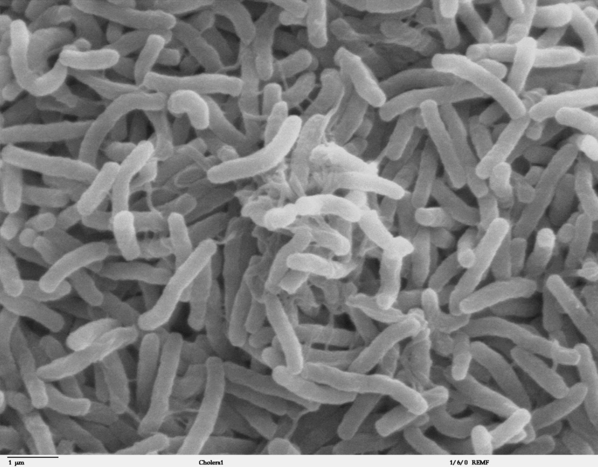 Cholera-Bakterien (Vibrio cholerae, Elektronenmikroskopie)