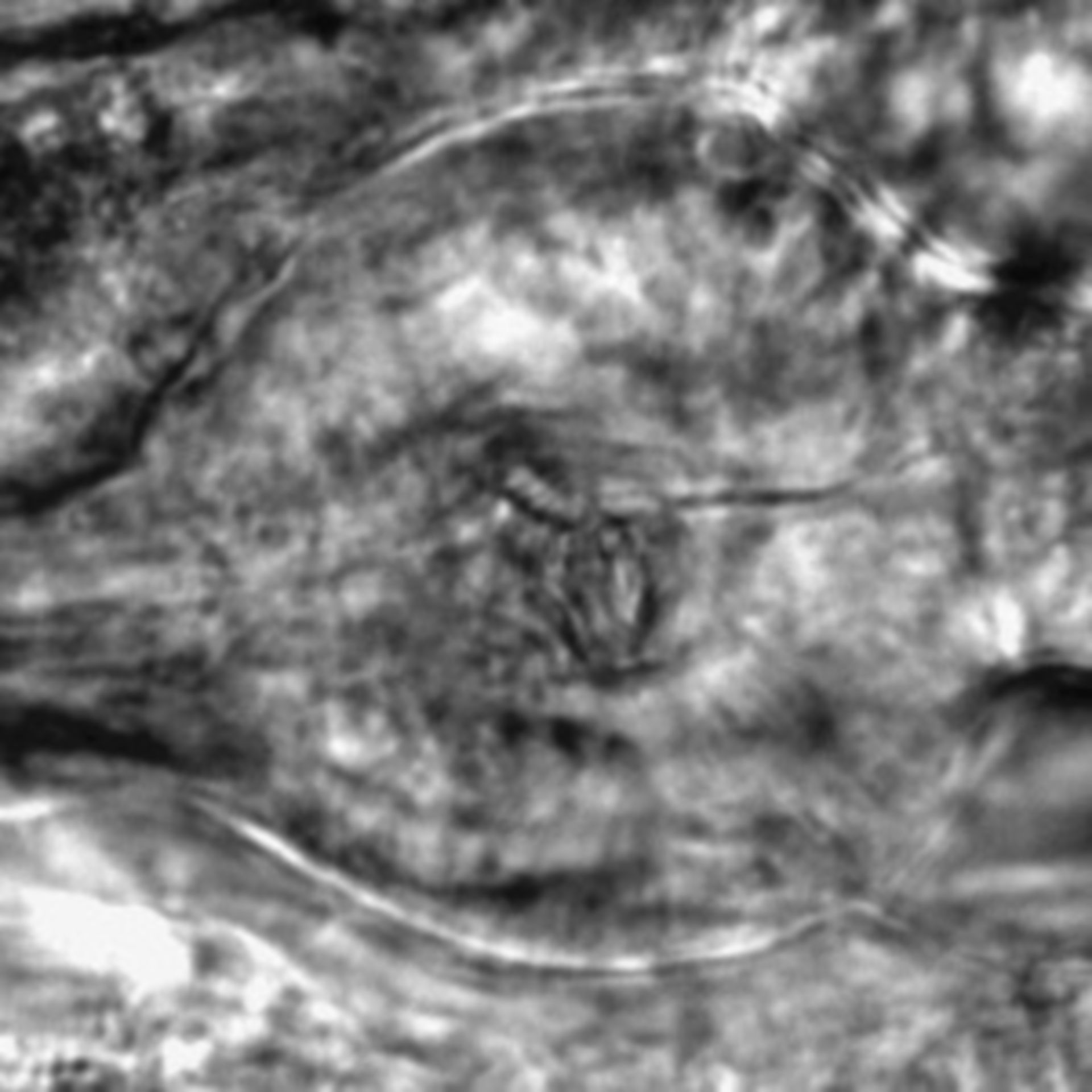 Caenorhabditis elegans - CIL:2837