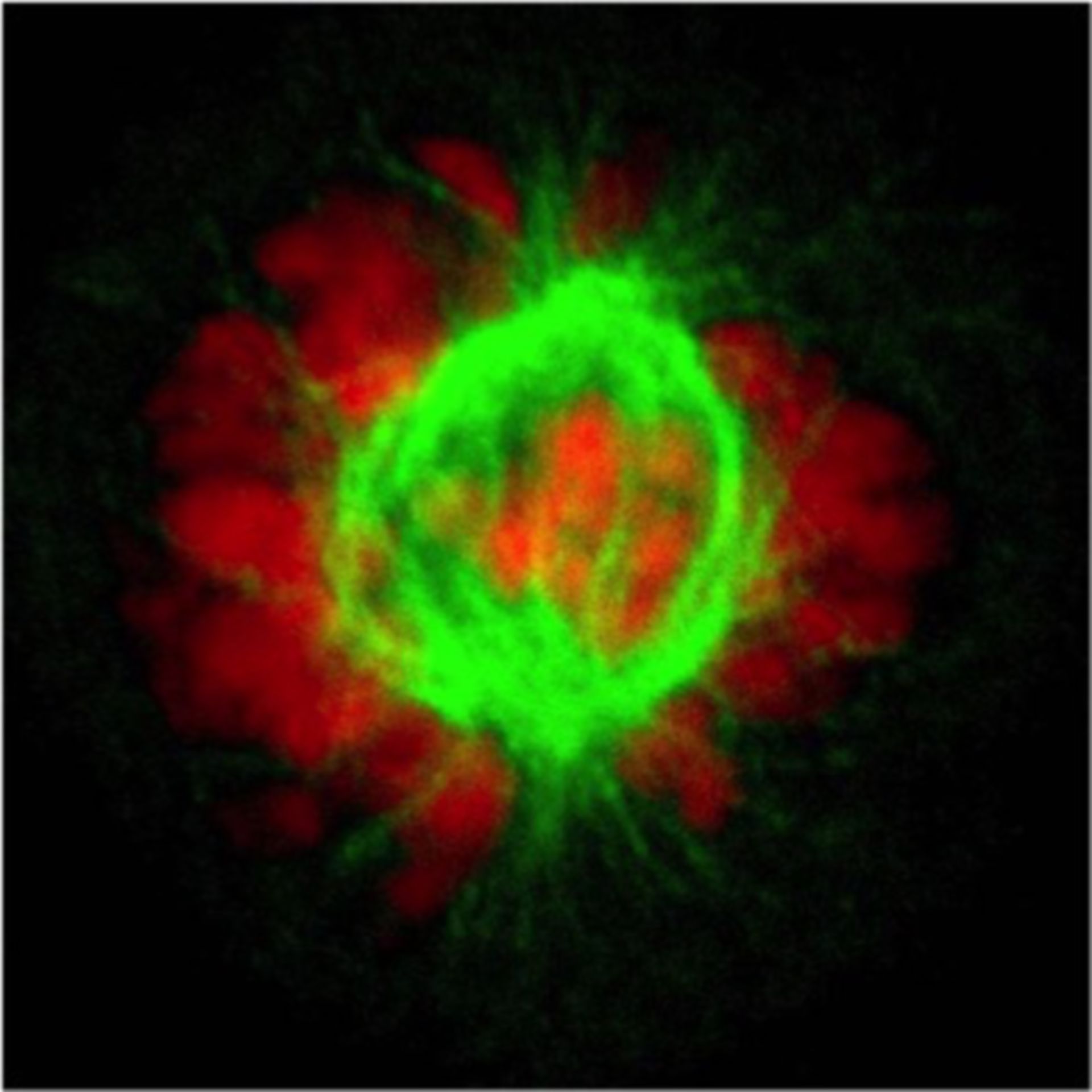 HeLa-Zellen in der Prometaphase