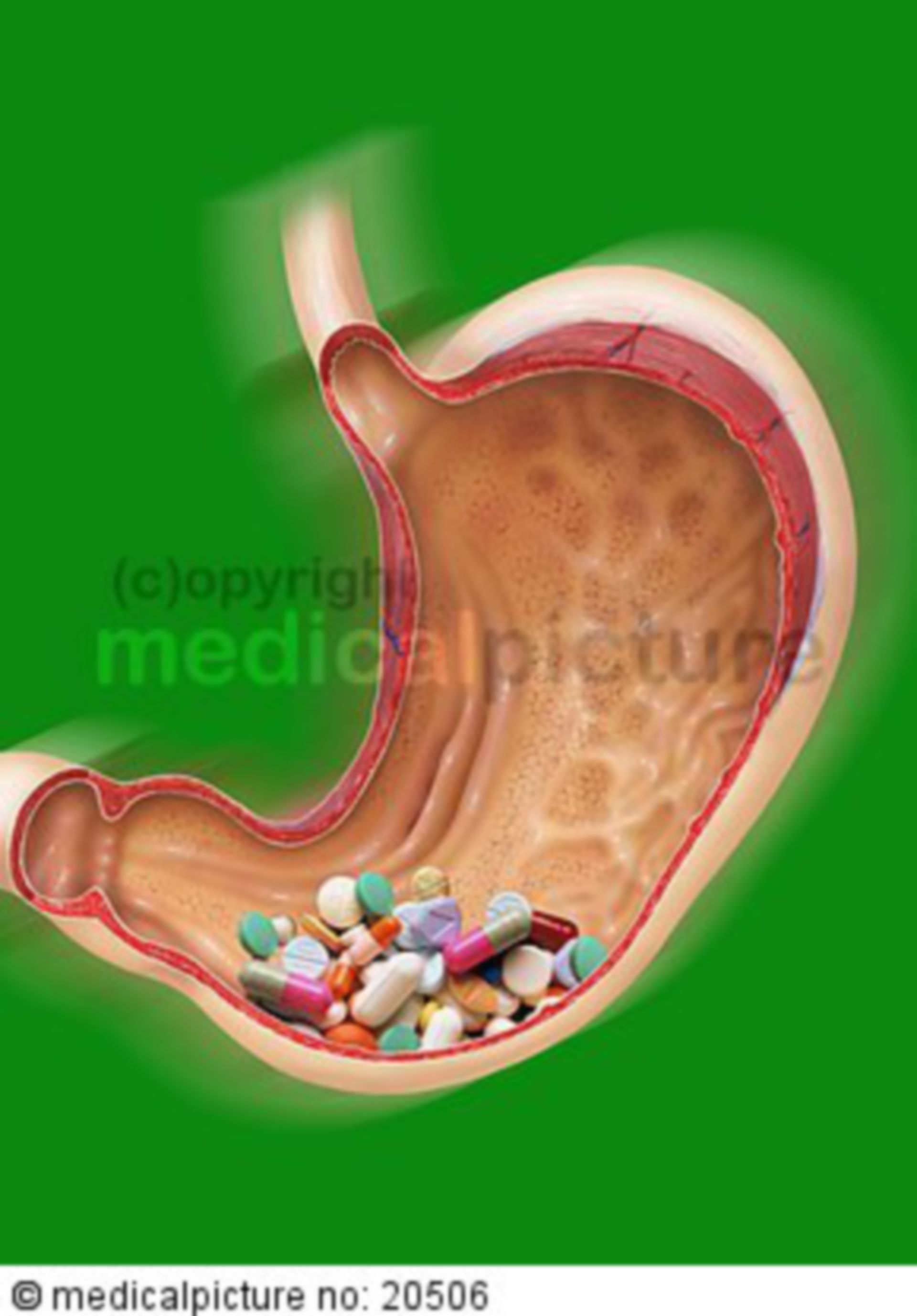 Medicaments in stomach