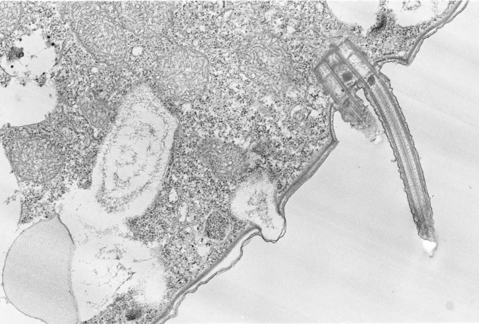 Colpoda cucullus (Cell cortex) - CIL:2856