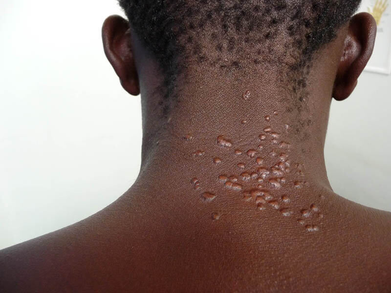 doccheck_-_12_-_neuesvomctm2024_-_00_-_skinofcolour_original.jpg