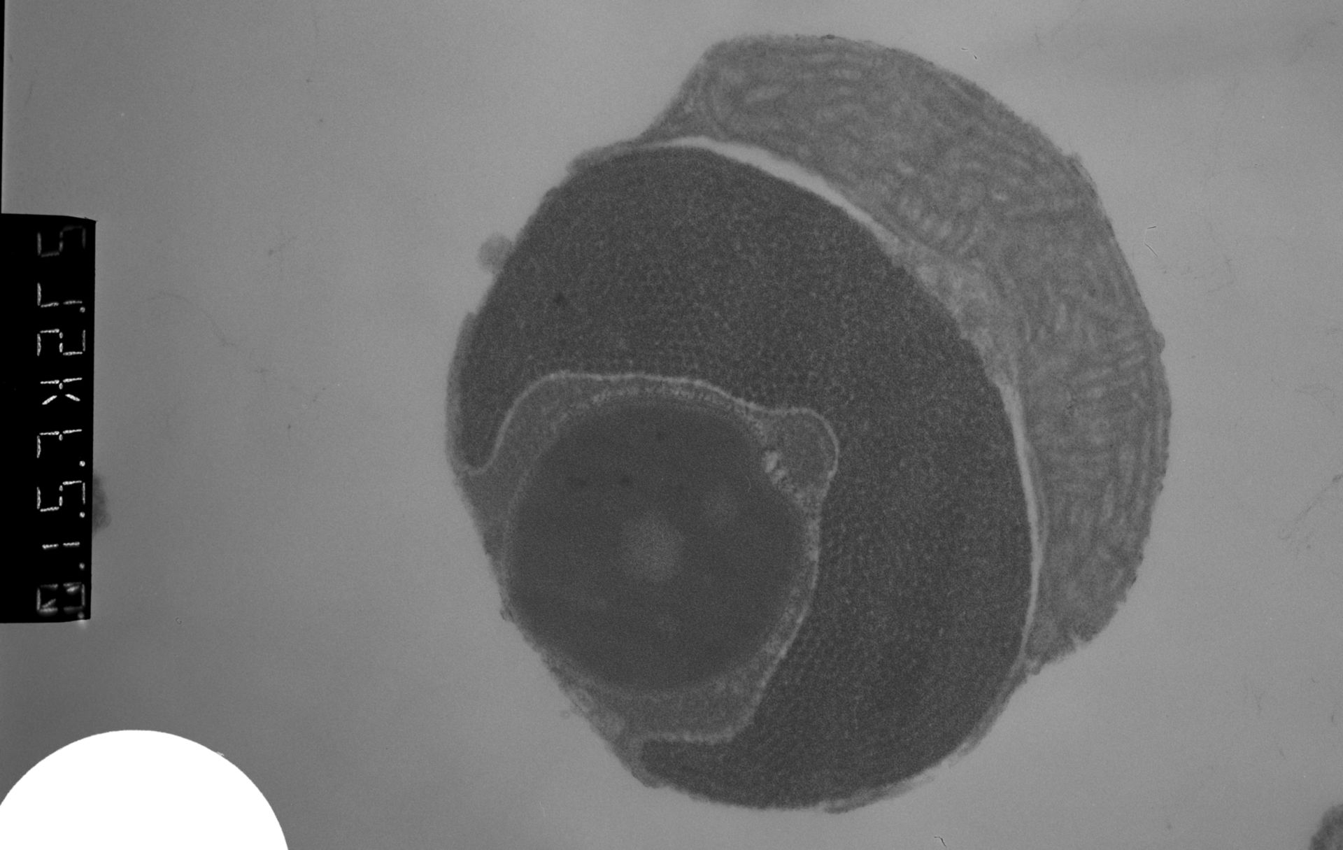 Patiria miniata (Male germ cell nucleus) - CIL:448