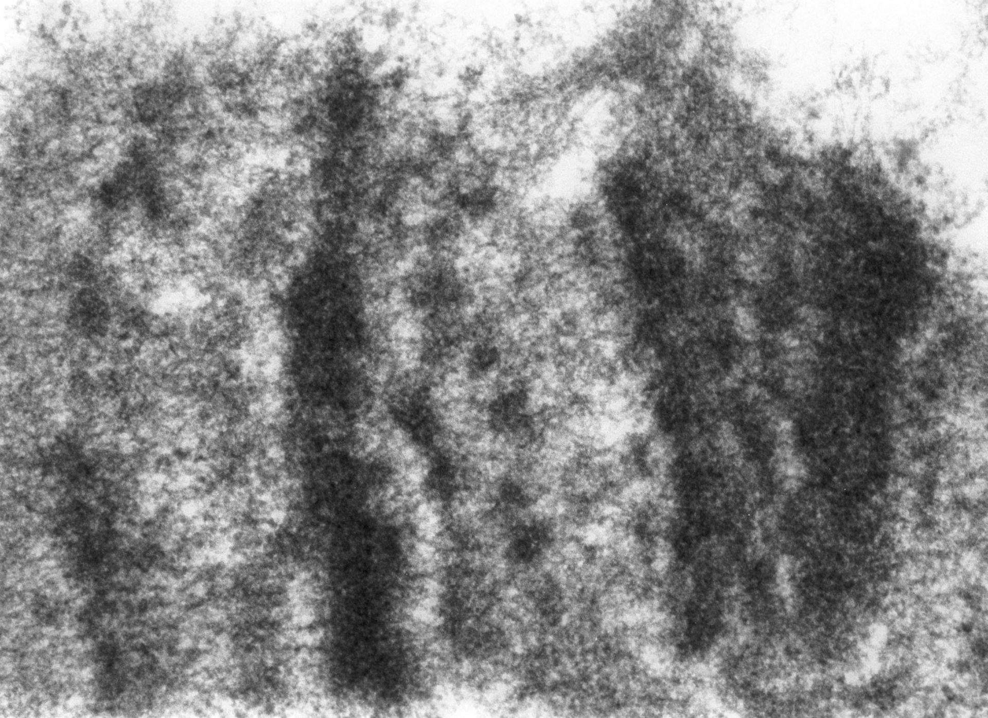 Drosophila melanogaster (Polytene chromosome) - CIL:24981