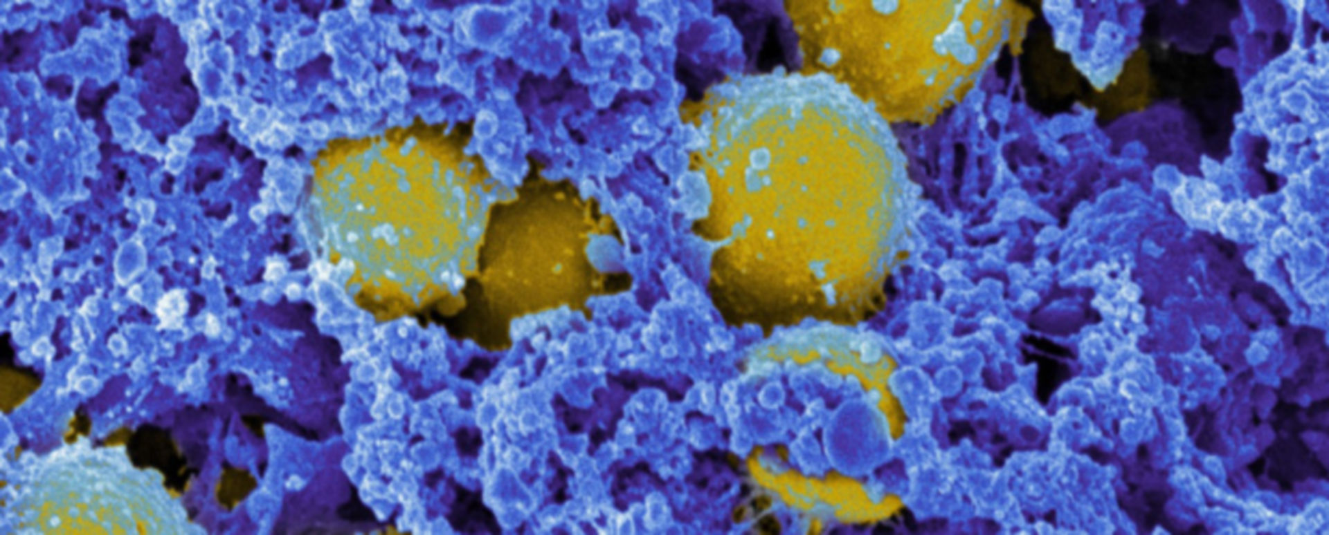 S aureus kontrollprotein f r toxinbildung erfasst doccheck