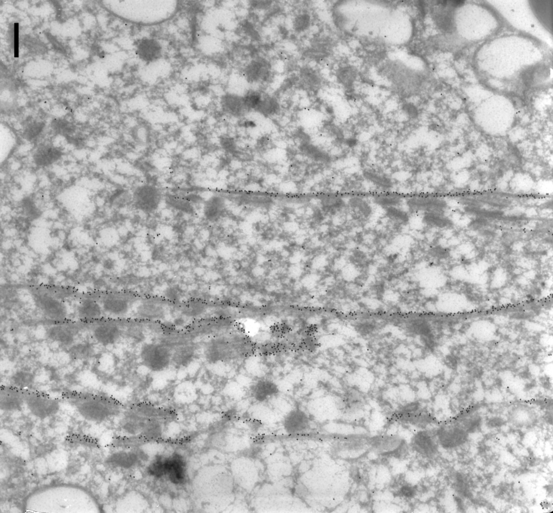 Paramecium tetraurelia (Microtubule associated complex) - CIL:9848