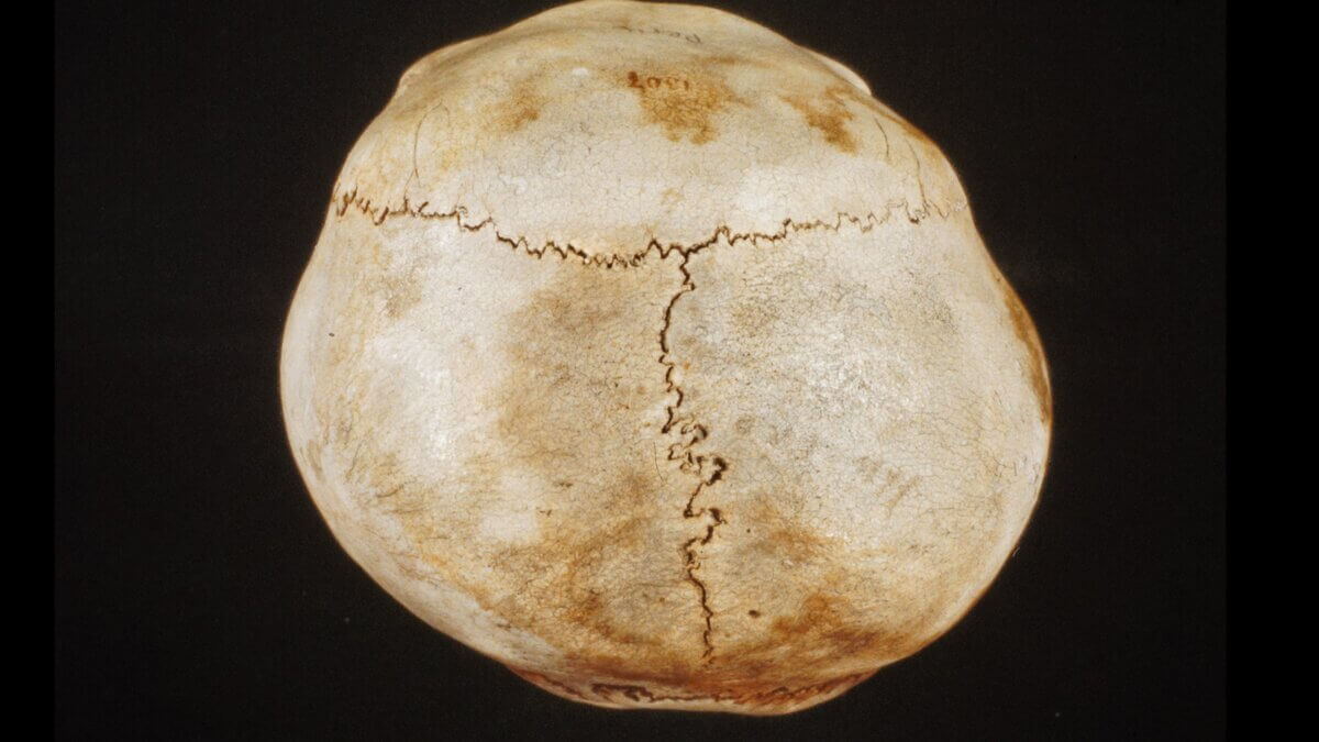 Sagittal- und Kranznaht