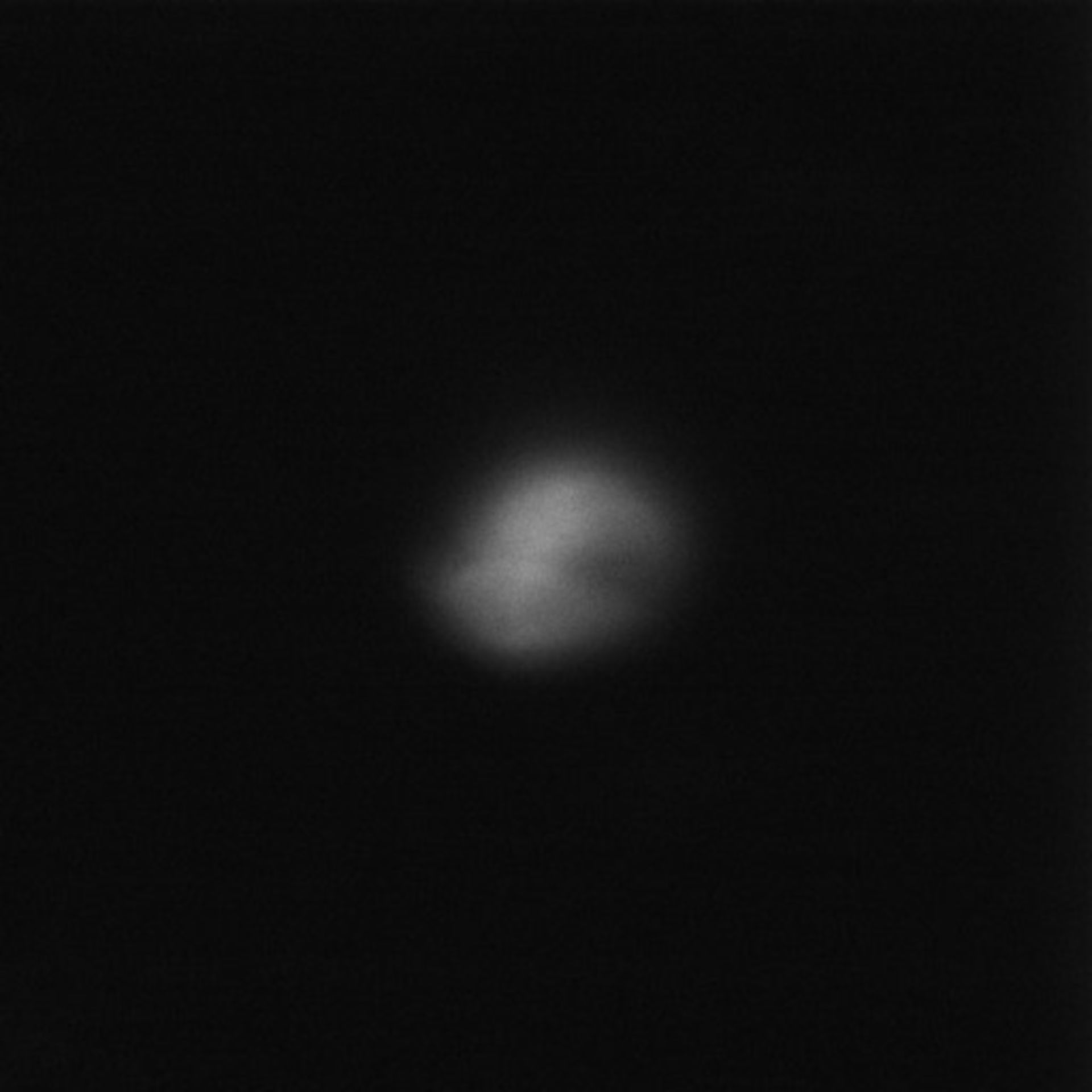 Toxoplasma gondii (Microtubule cytoskeleton) - CIL:10526