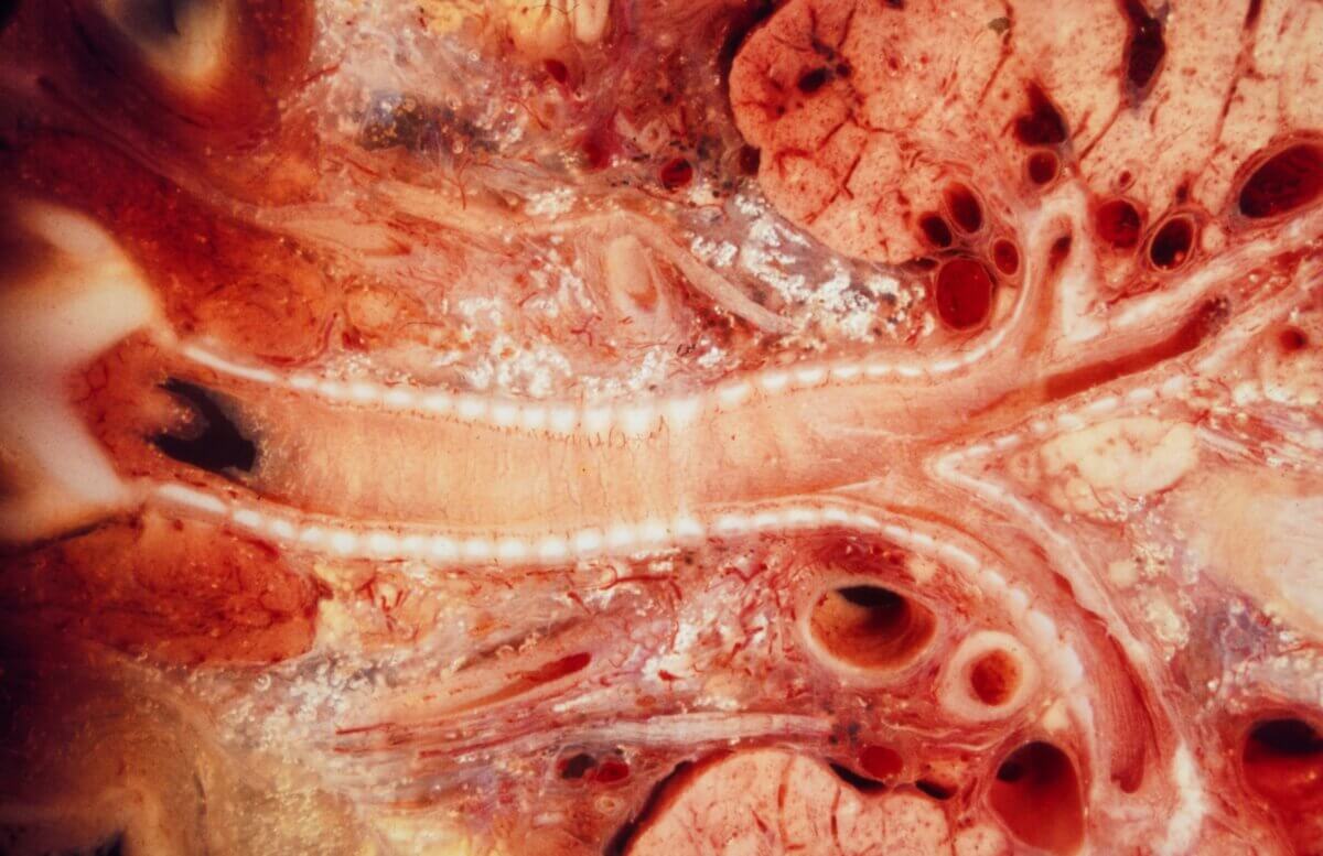 Frontalebenenschnitt durch die Trachea