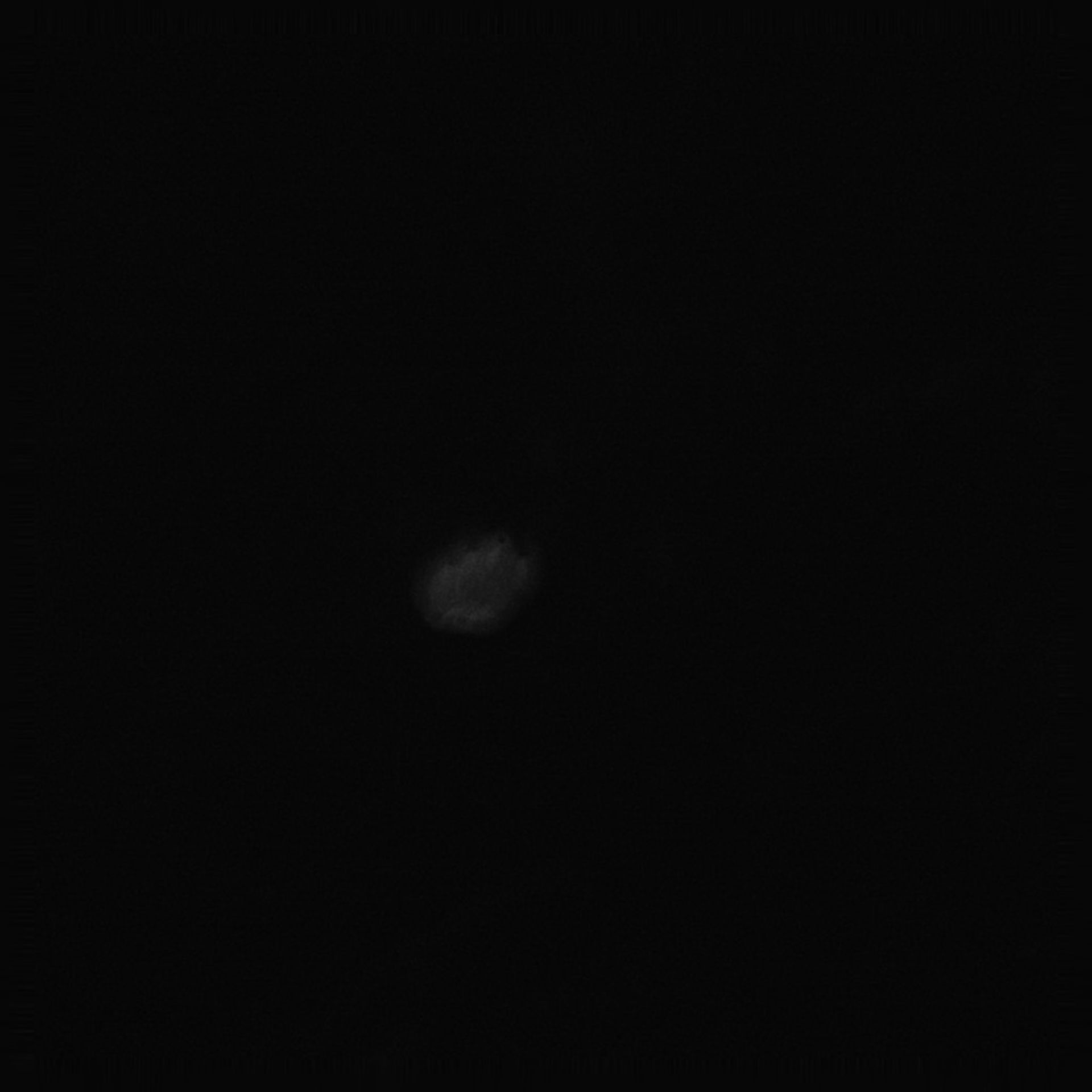 Toxoplasma gondii RH (Cortical microtubule) - CIL:10469