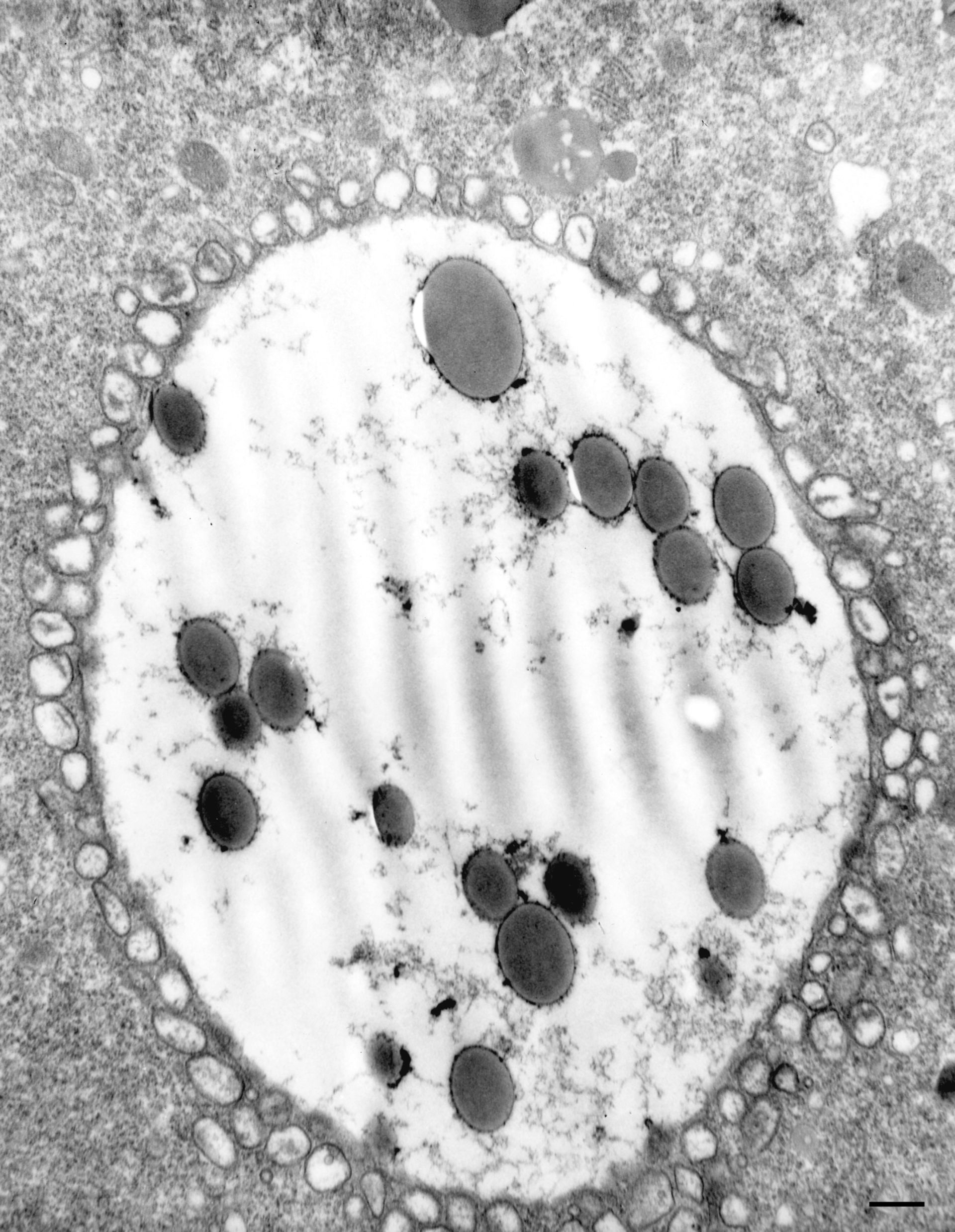 Paramecium multimicronucleatum (Secondary lysosome) - CIL:36736